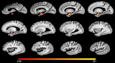 1d1b28d44ee5945f44b9fbea42780f53.png 1d1b28d44ee5945f44b9fbea42780f53.png