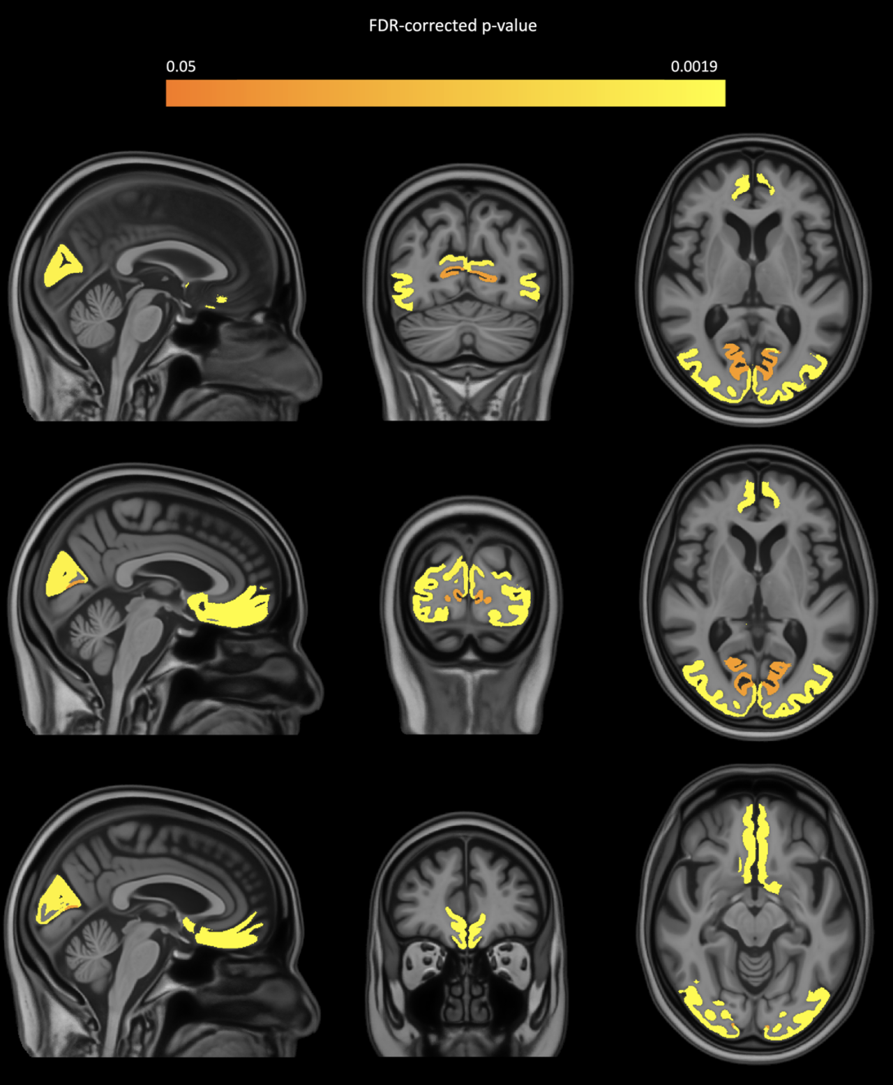 91298309891b19bf6a392de32bf7df33.png 91298309891b19bf6a392de32bf7df33.png