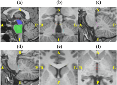 a548379d8c2fd8c344b95468c93201a1.png a548379d8c2fd8c344b95468c93201a1.png