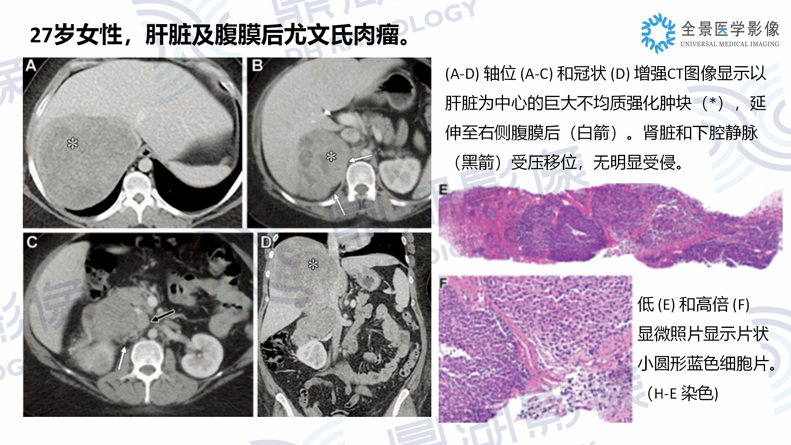 a230a908bb88e137cfa883b5bb7cb18b.jpg