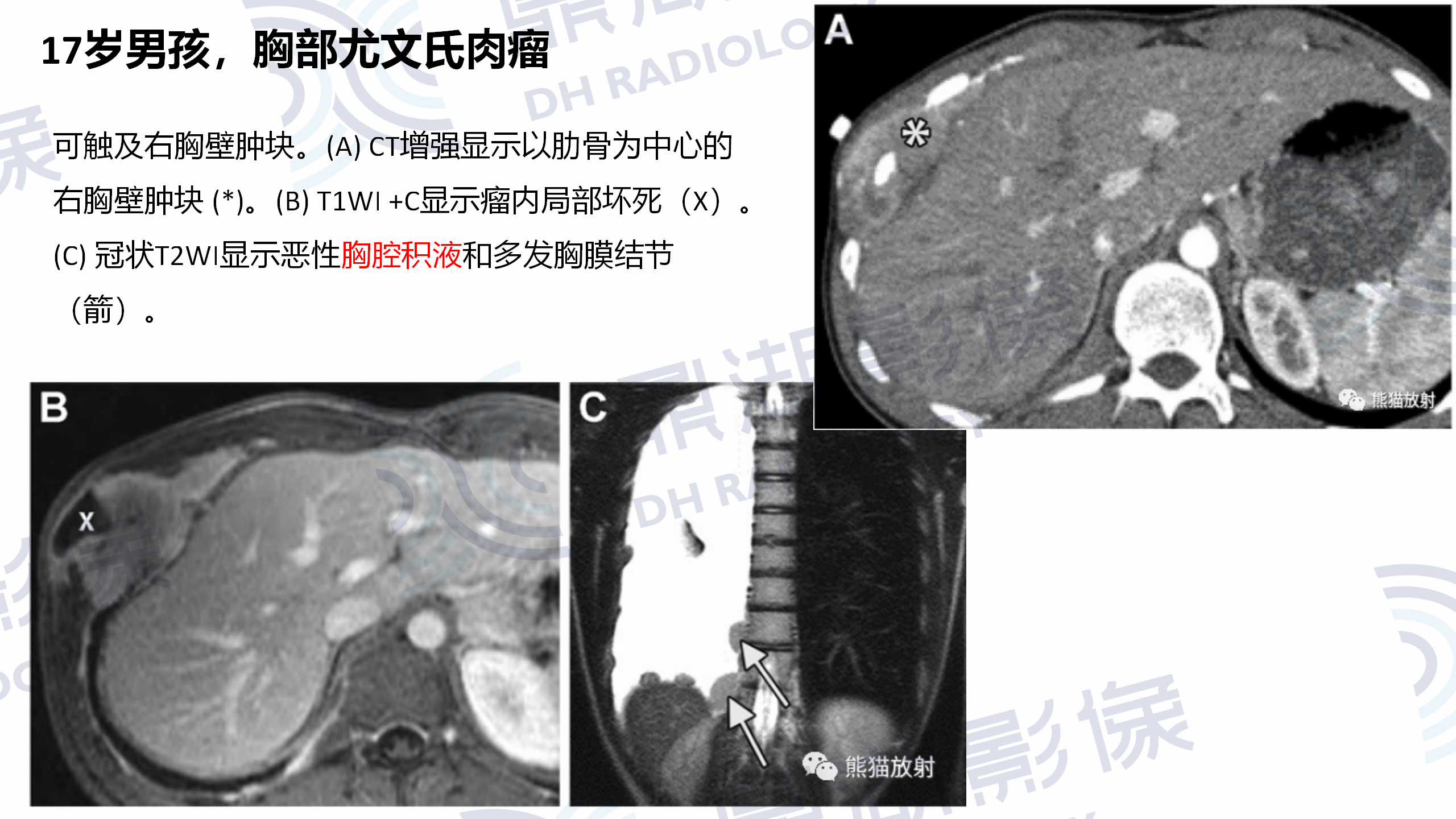 a972b260e9fc1a712a1e694ac4aa6d81.jpg