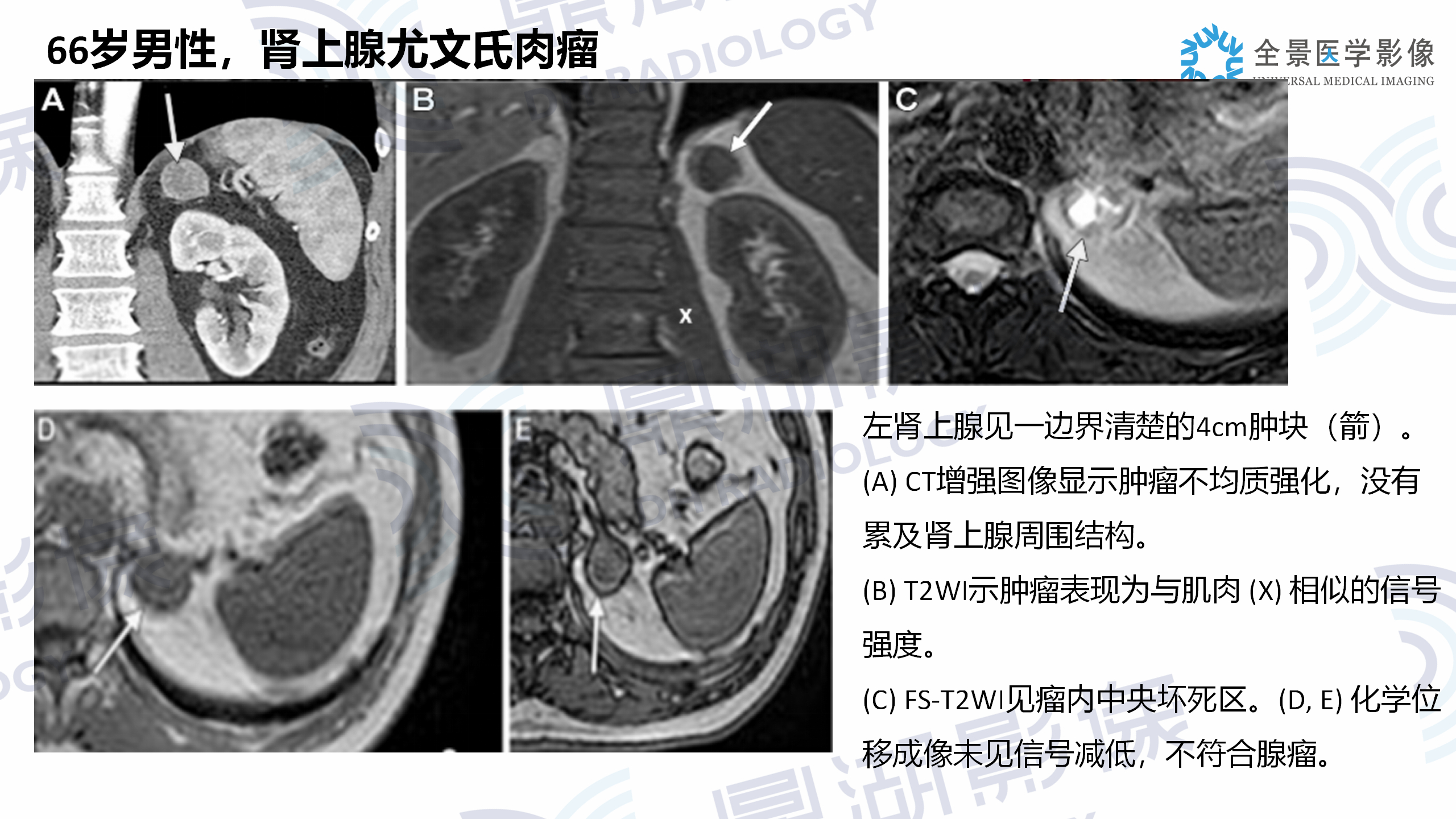 dba82203624c4ec535b681bf4b5cdbac.jpg