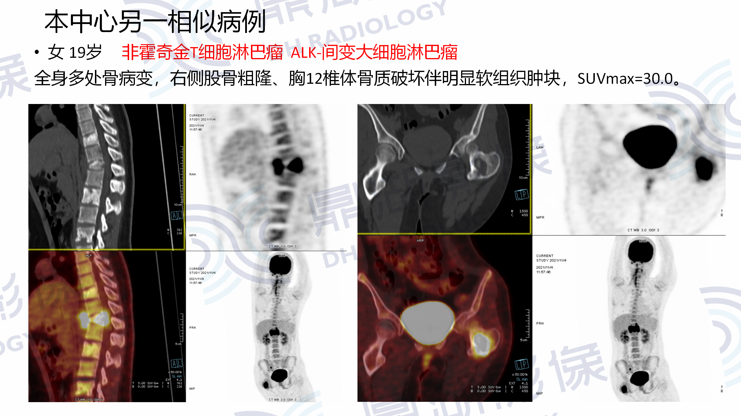 a82908cd400604aa899737abe7f13494.jpg