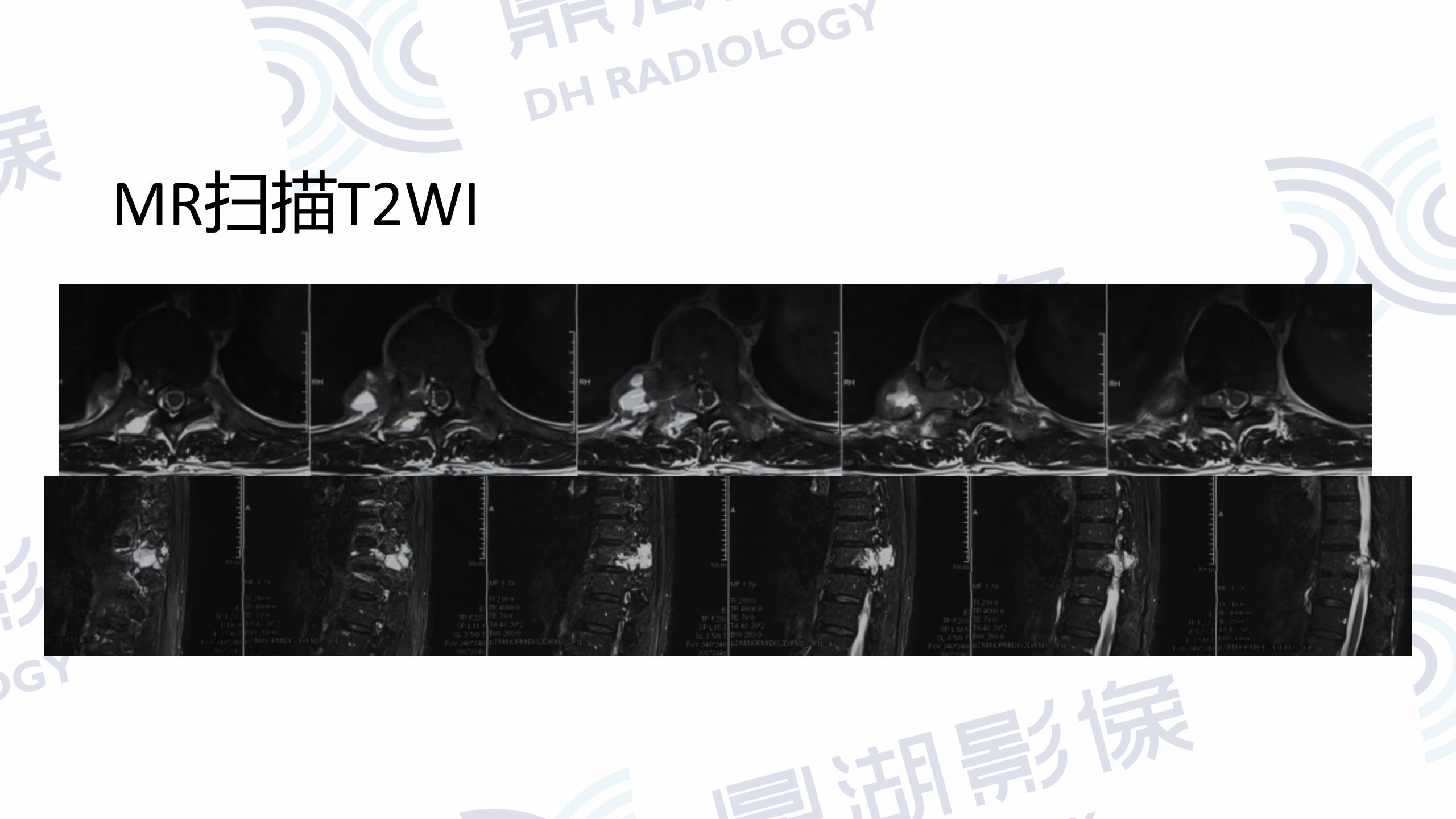 32d9e71de0246e13403818713dcd8a60.jpg 32d9e71de0246e13403818713dcd8a60.jpg