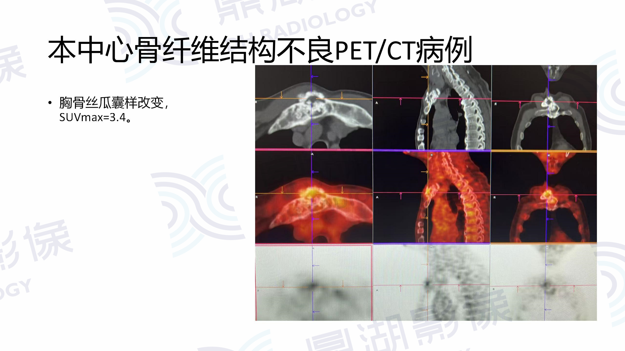 7080acb701531aa7b7d1127fa336e307.jpg