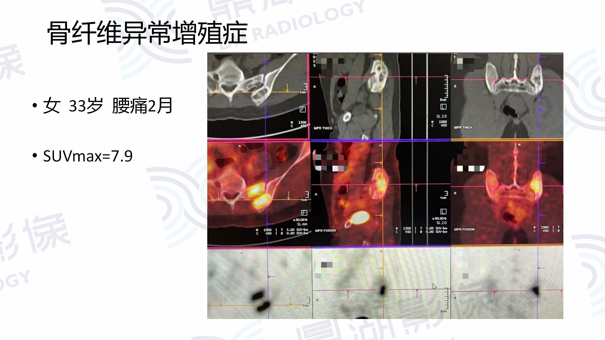 c9abe587a3472413e0bcf79b4dd2b34e.jpg c9abe587a3472413e0bcf79b4dd2b34e.jpg