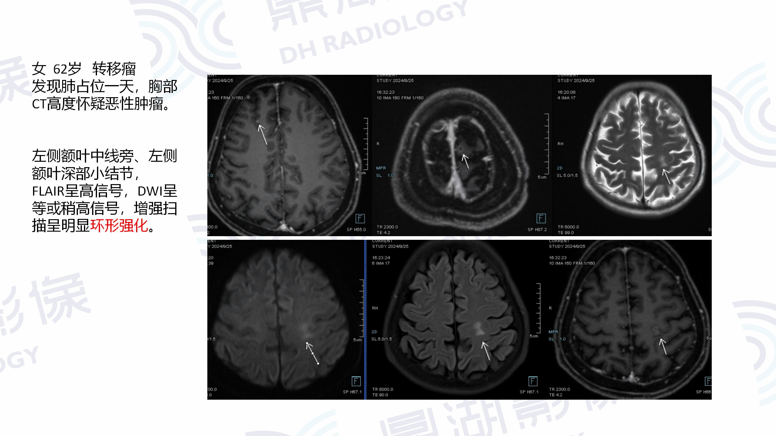 0f27a501790508d3524e4256f1cbd03b.jpg 0f27a501790508d3524e4256f1cbd03b.jpg
