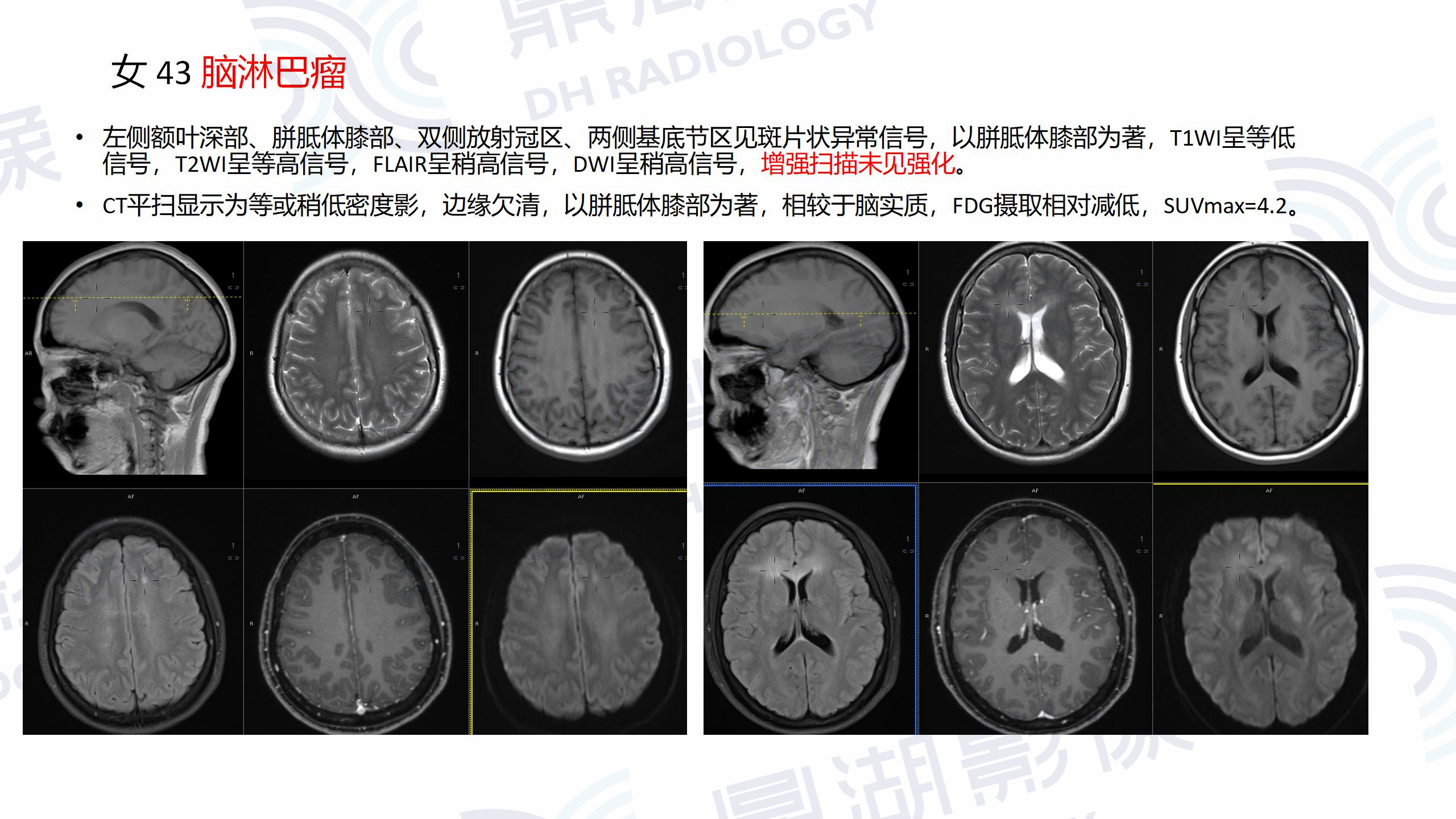db654a5cbd14ca07f4b7cfefbfa3885a.jpg db654a5cbd14ca07f4b7cfefbfa3885a.jpg