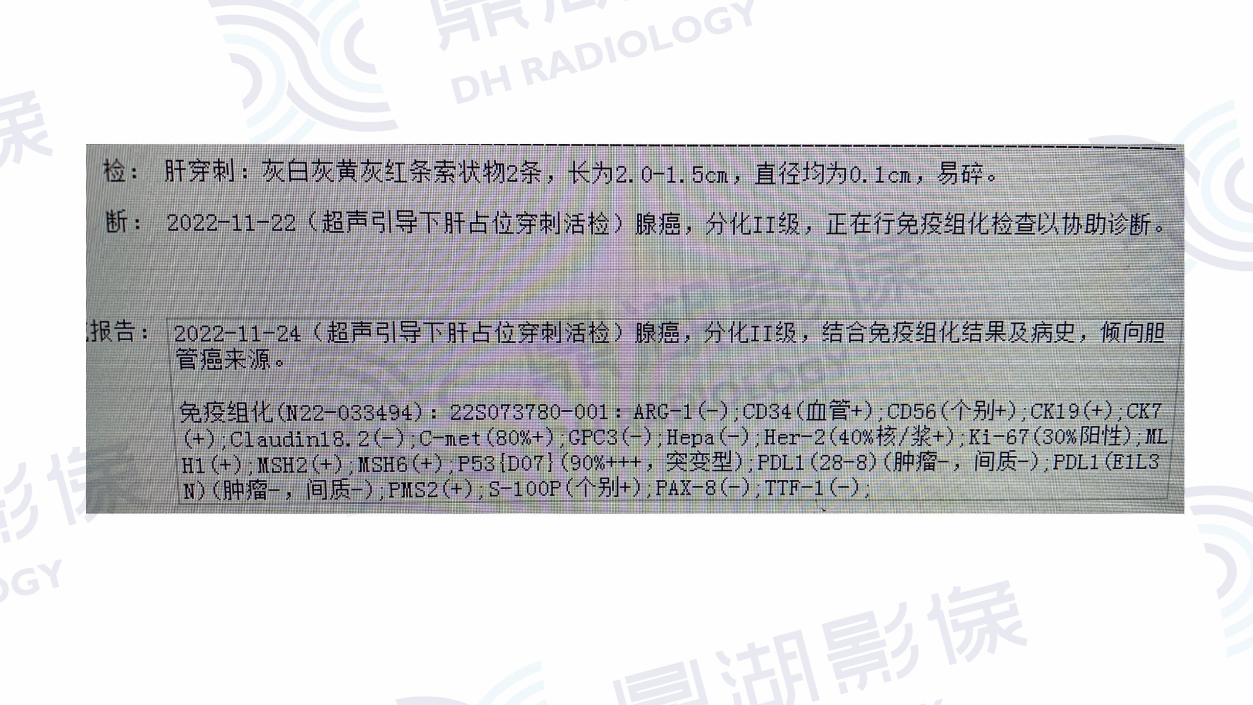 f5c61eb1cf12560ec29b3a543aca1629.jpg