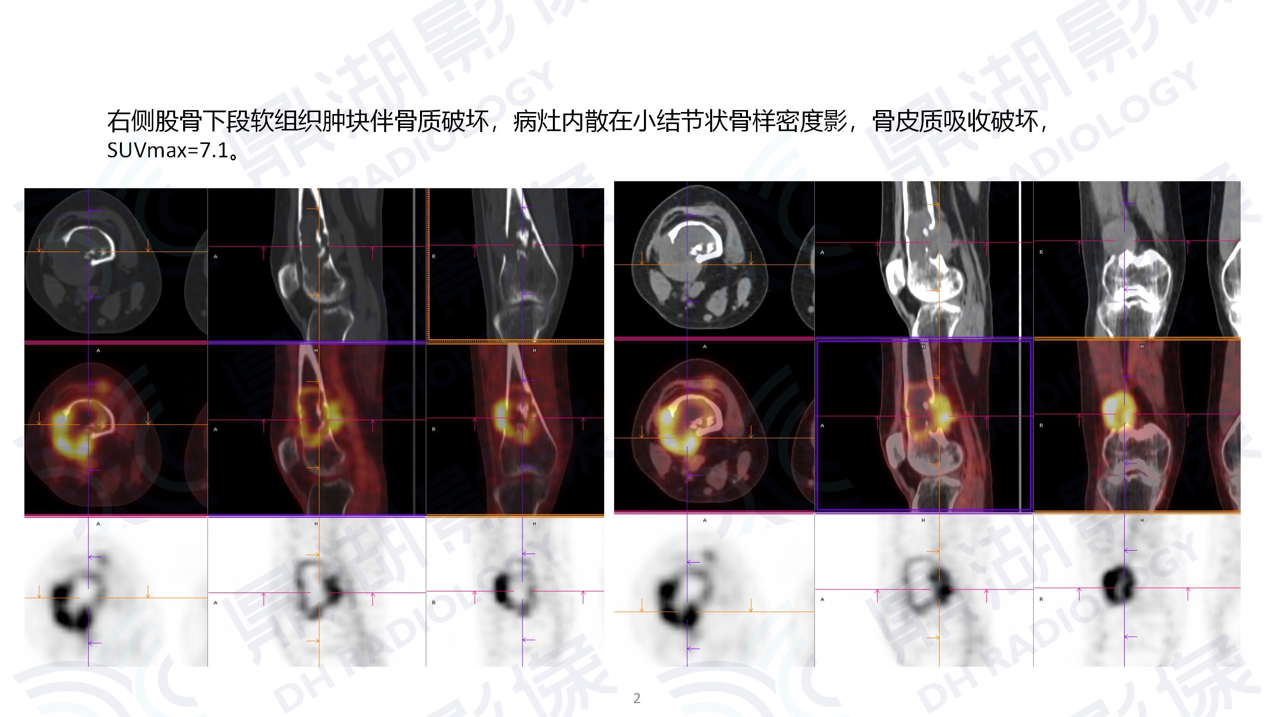 25b3bd64255c5d8959a790fc95662f6d.jpg 25b3bd64255c5d8959a790fc95662f6d.jpg