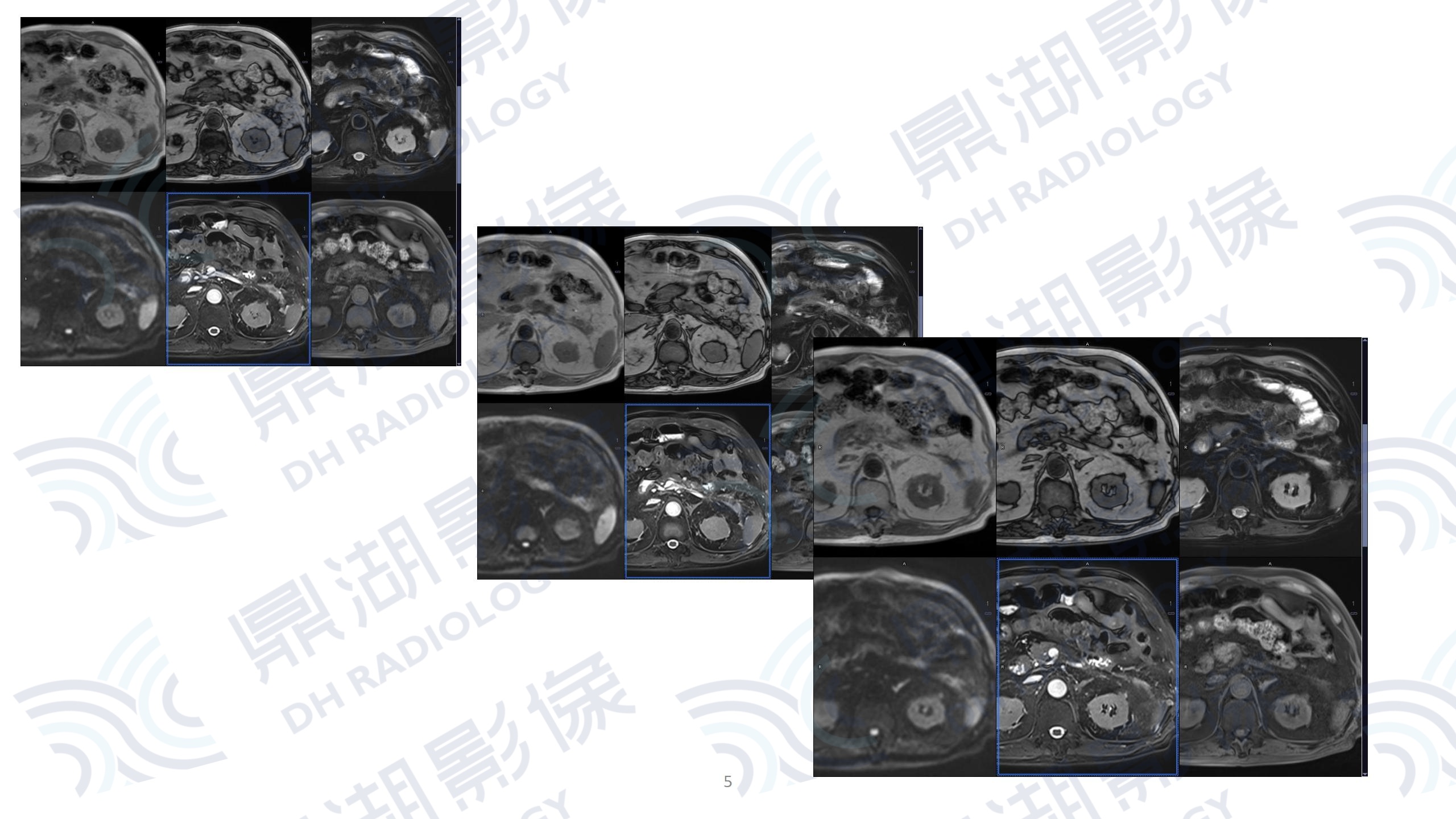 08bd065345df7d0d2b815b99938da241.jpg 08bd065345df7d0d2b815b99938da241.jpg