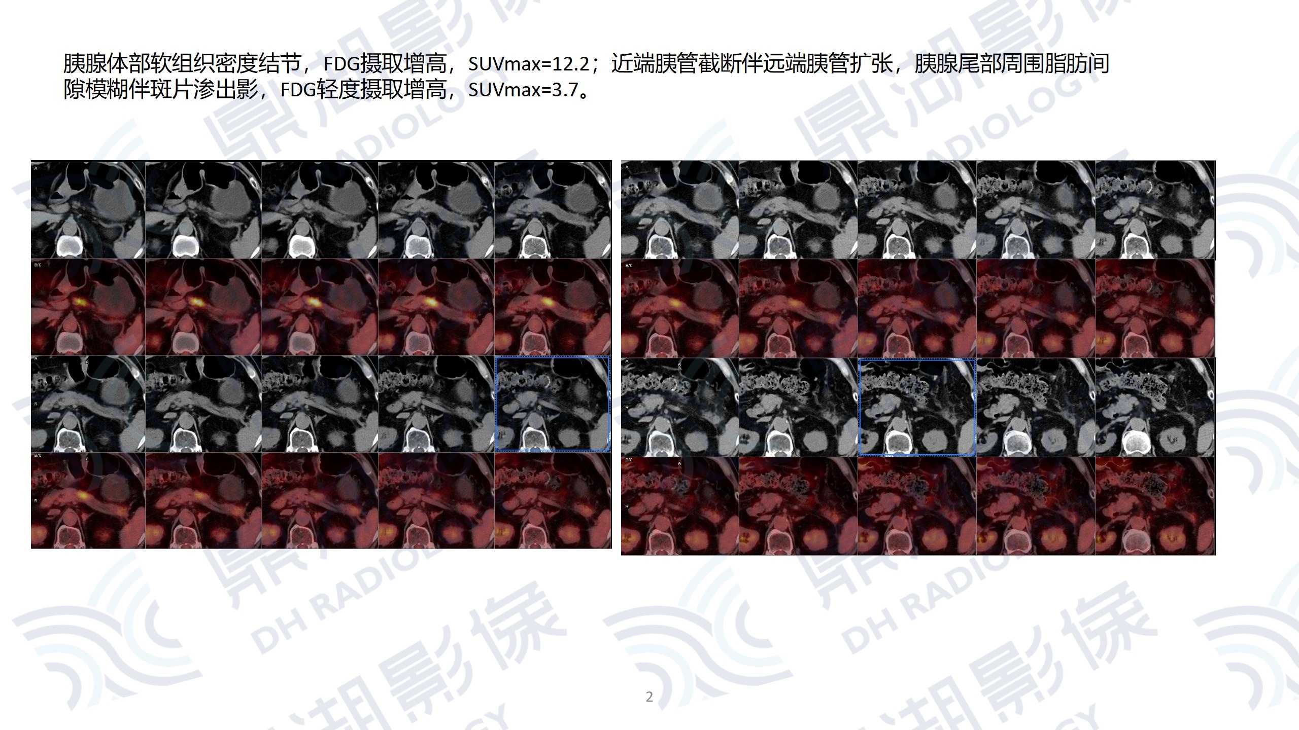 9dbb6dc40be4e83ac036465a293f7634.jpg 9dbb6dc40be4e83ac036465a293f7634.jpg