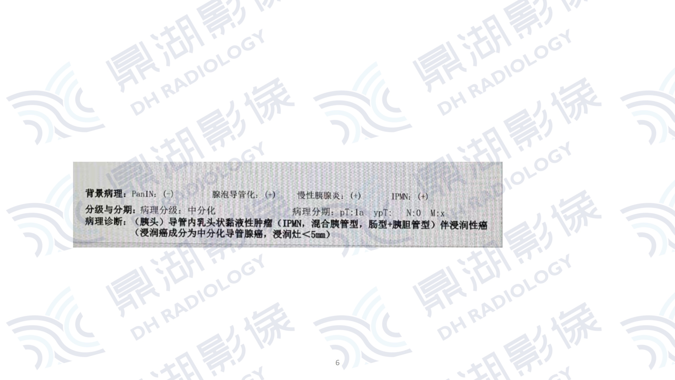 bd41e9d6233a178ffc615b3a9c18a2f1.jpg bd41e9d6233a178ffc615b3a9c18a2f1.jpg