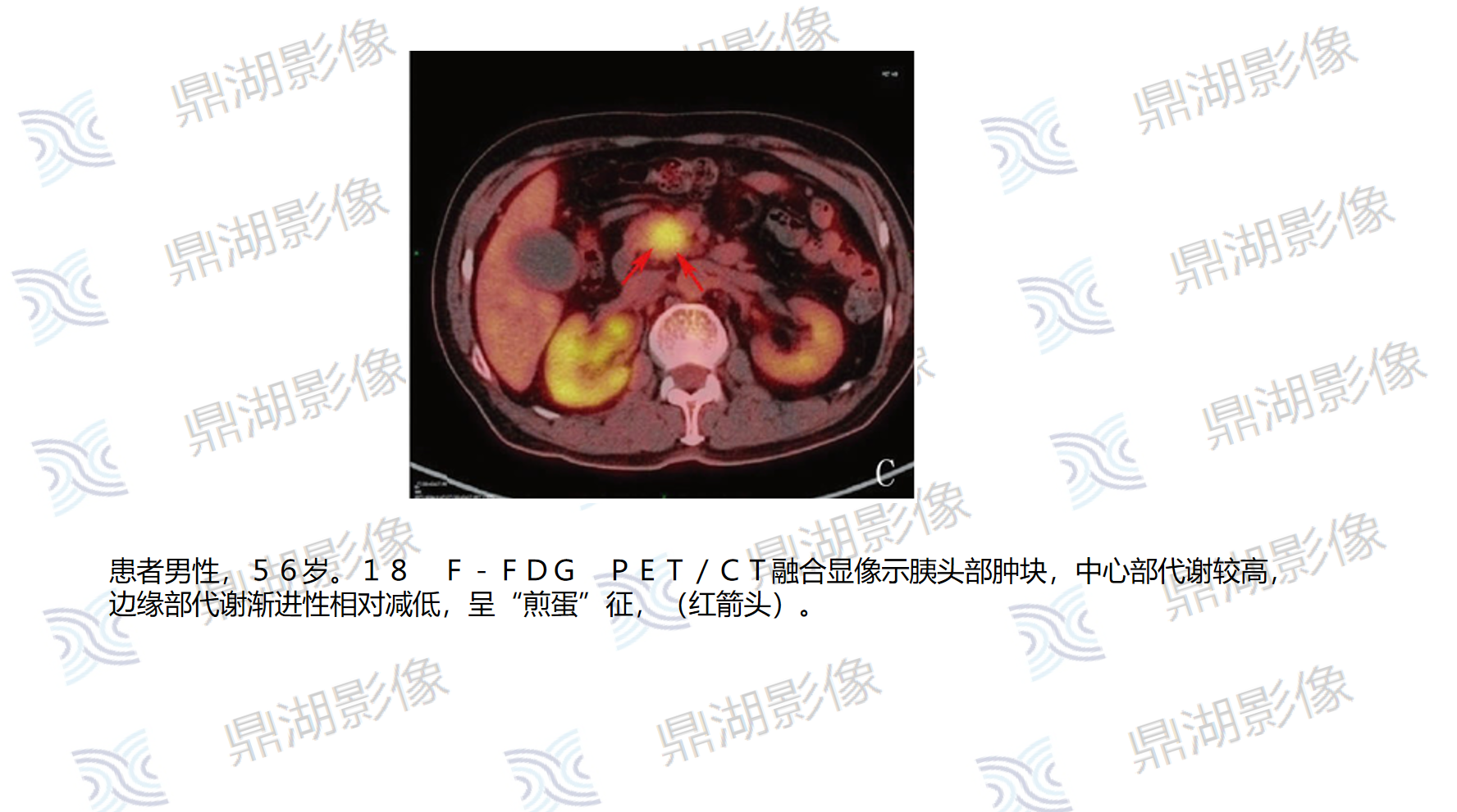 21a06812f19a53d1bd42c76510a1f623.png 21a06812f19a53d1bd42c76510a1f623.png
