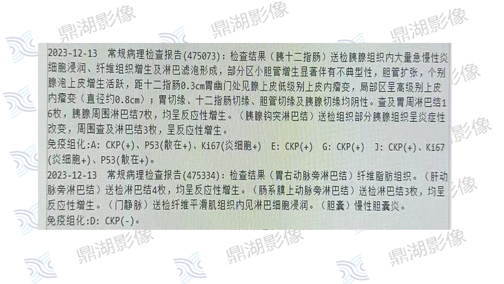 ebbf7fc9fd9cf7bd1e497dc4627c0884.png ebbf7fc9fd9cf7bd1e497dc4627c0884.png