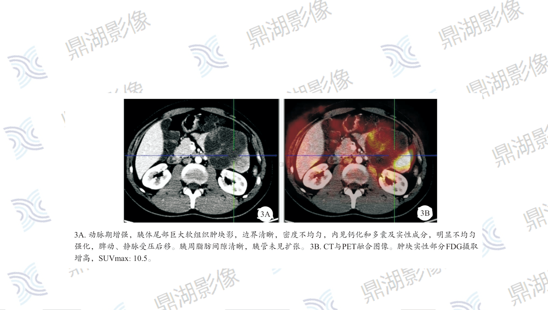 5ca6cc0daea927633ed720c4bd614319.png 5ca6cc0daea927633ed720c4bd614319.png