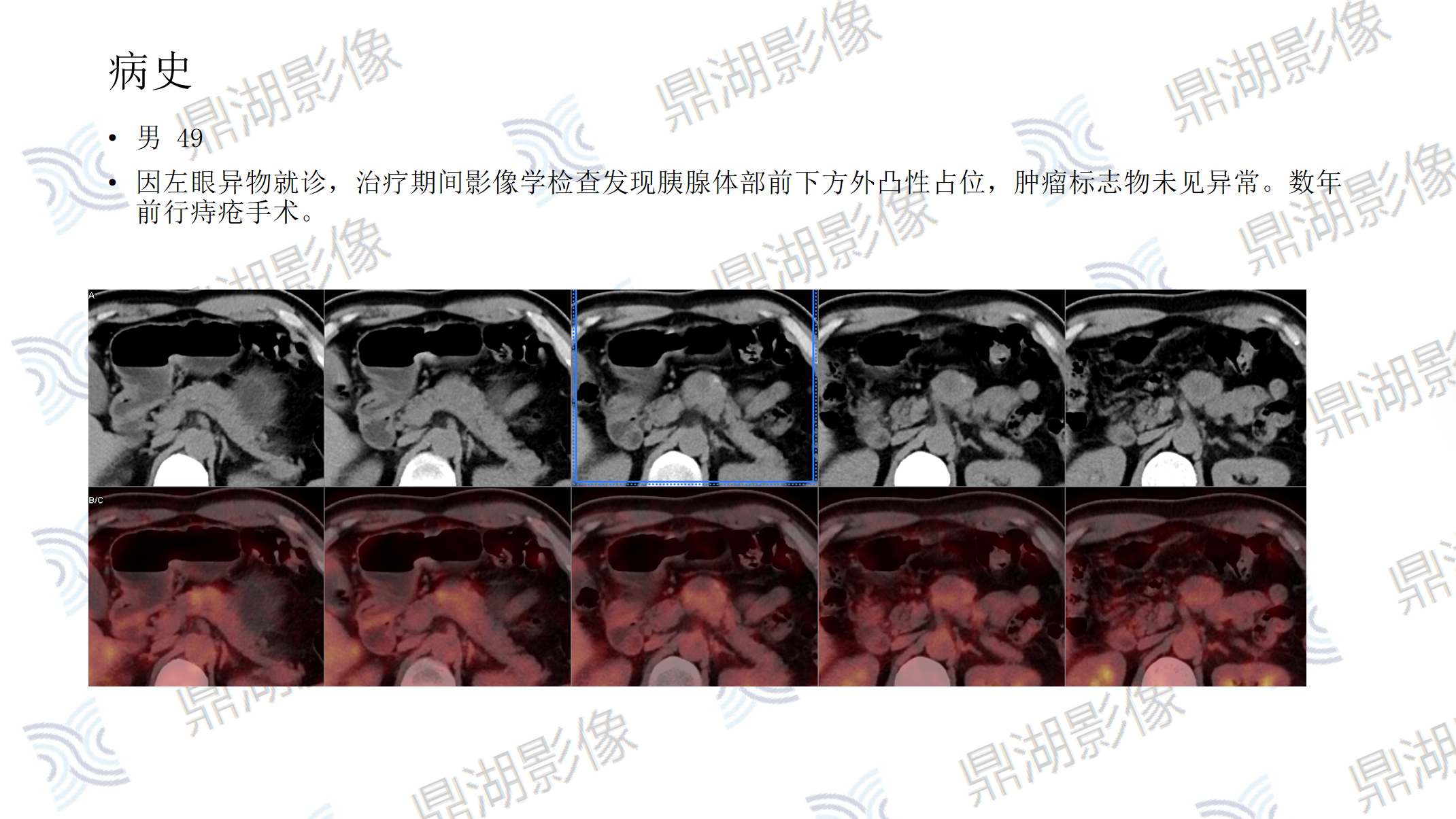 7be9d8ecacfa476293d0621413ad3d89.png 7be9d8ecacfa476293d0621413ad3d89.png