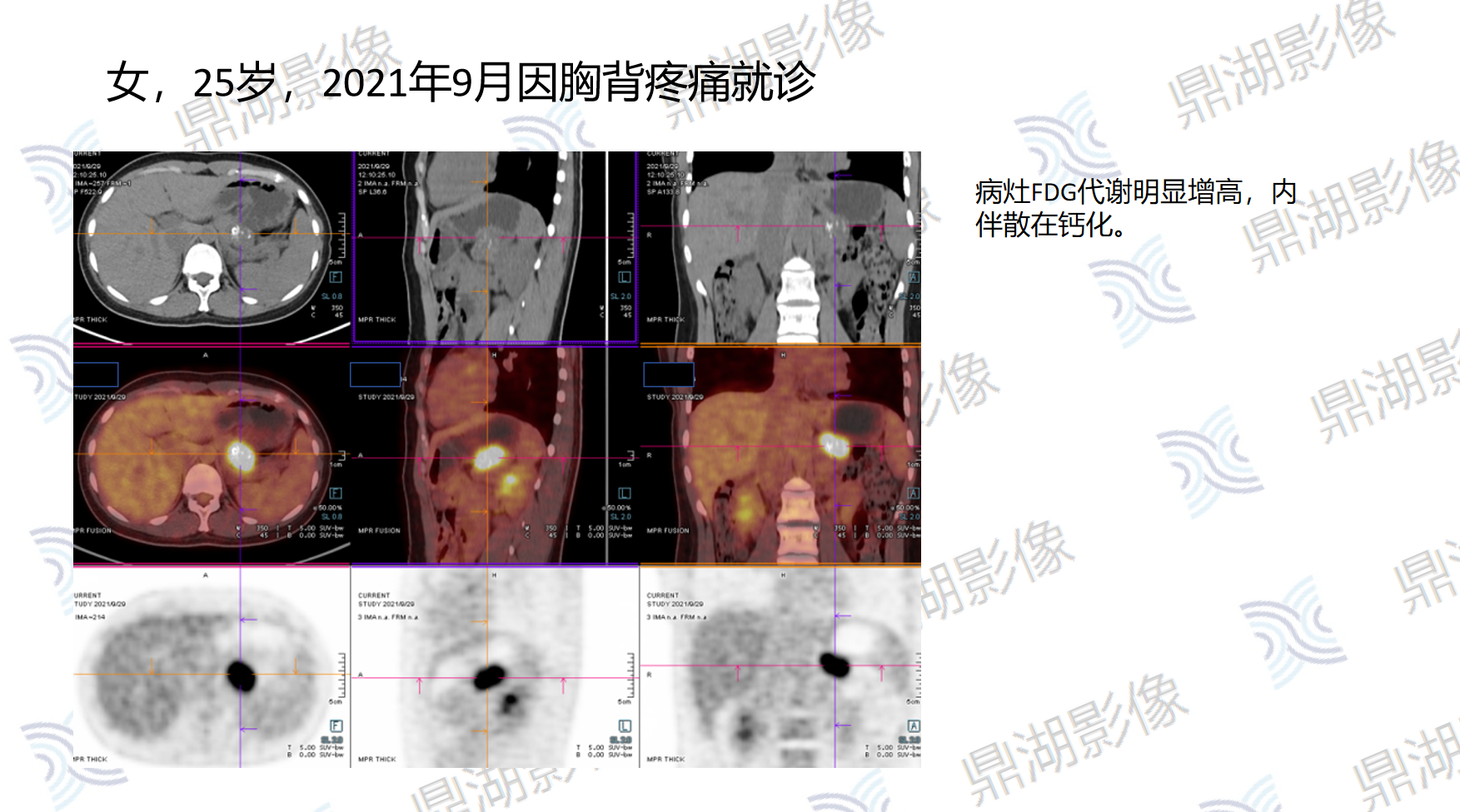 93b2722890f8a6ef540bccc7f2ae4fd9.png 93b2722890f8a6ef540bccc7f2ae4fd9.png
