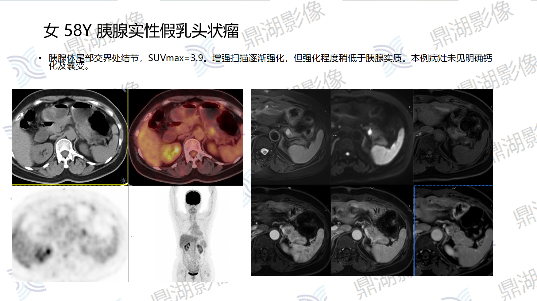 a737cd764c6a3b56e90b2acf864b49ad.png a737cd764c6a3b56e90b2acf864b49ad.png
