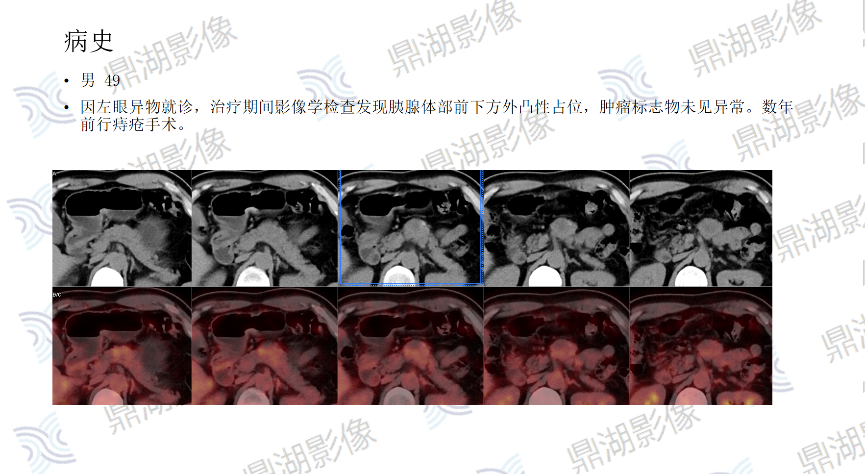 20dbc9929c7c4f6899ed9d8ec4b305de.png 20dbc9929c7c4f6899ed9d8ec4b305de.png