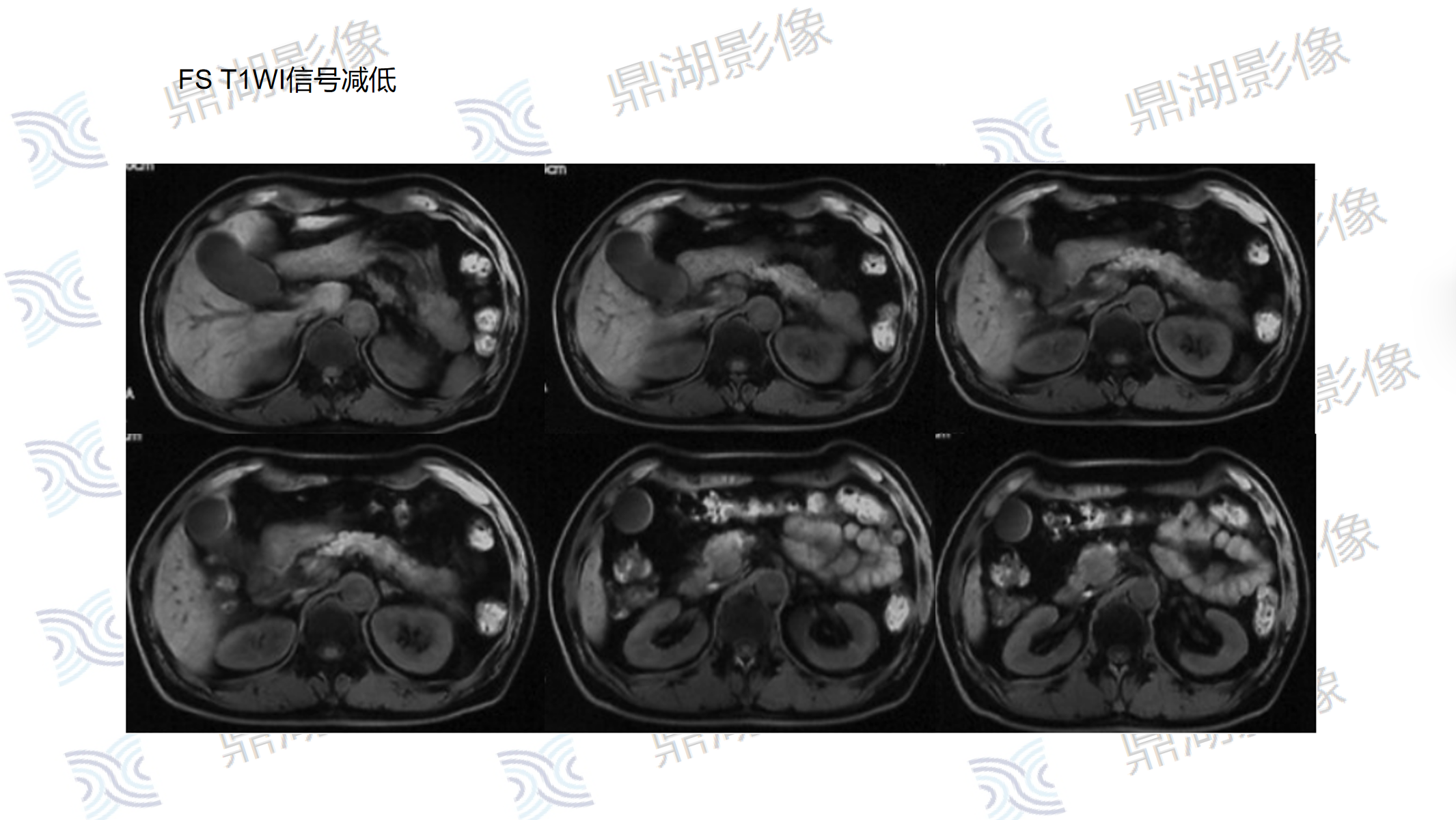 1dd9900038c7d8d2aac40aba85d301b7.png
