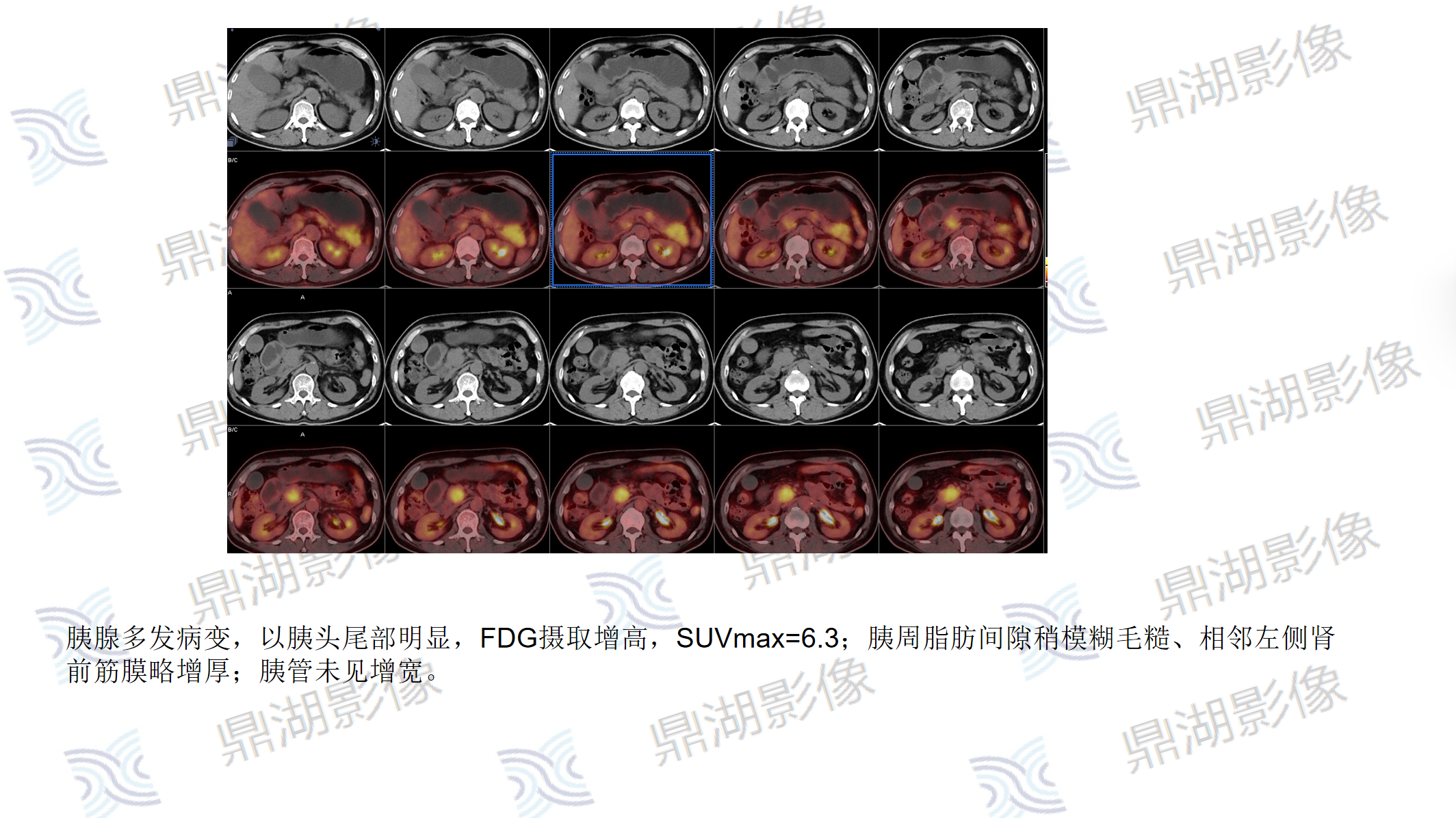 550f6b02a62110d8c5e48bc1a86fa348.png
