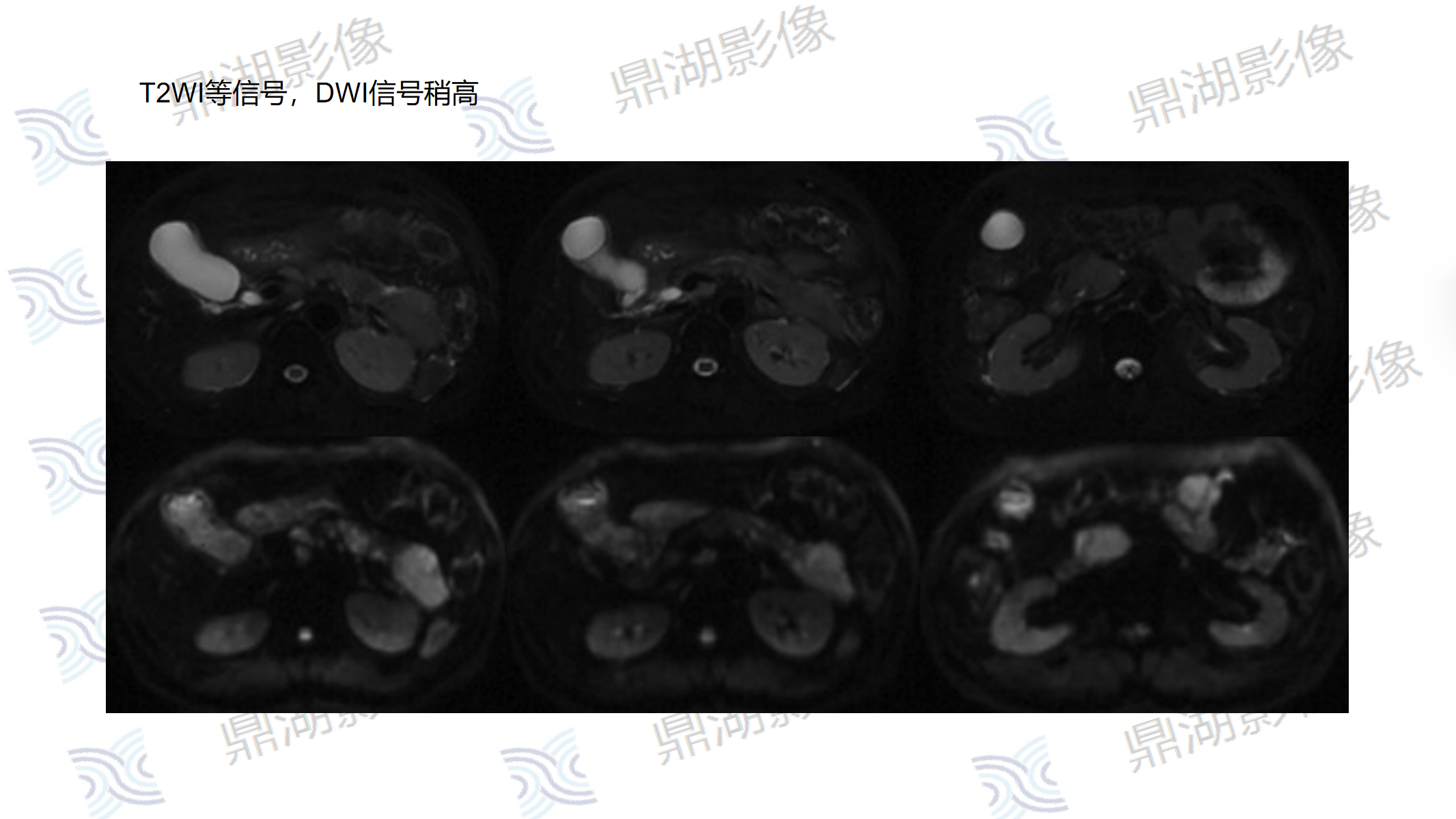 72f4b0a7298420db076e9dc1baea2e8c.png