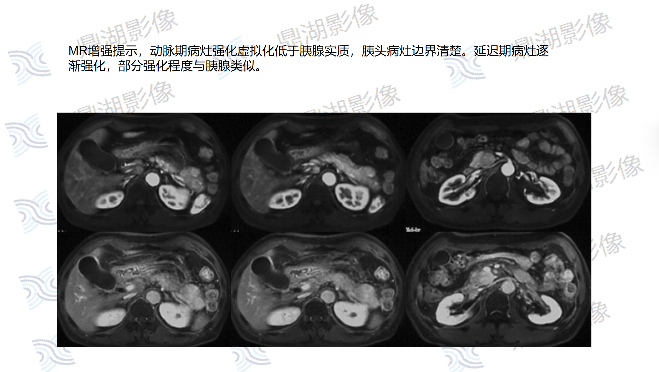 d8e5ad860826b7f4cb2e9c0834673c40.png