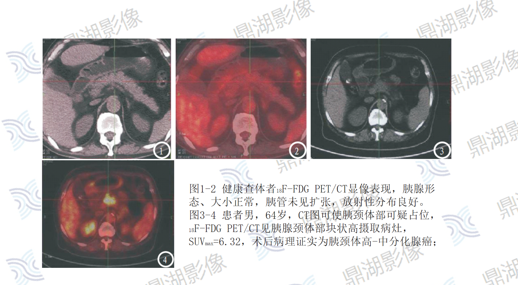 fca7da8071e93bf9d76d4d2e6f0ae1e7.png