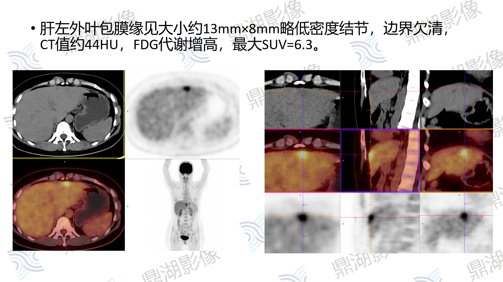 b5293c640ac9636f229526e1510d797d.png