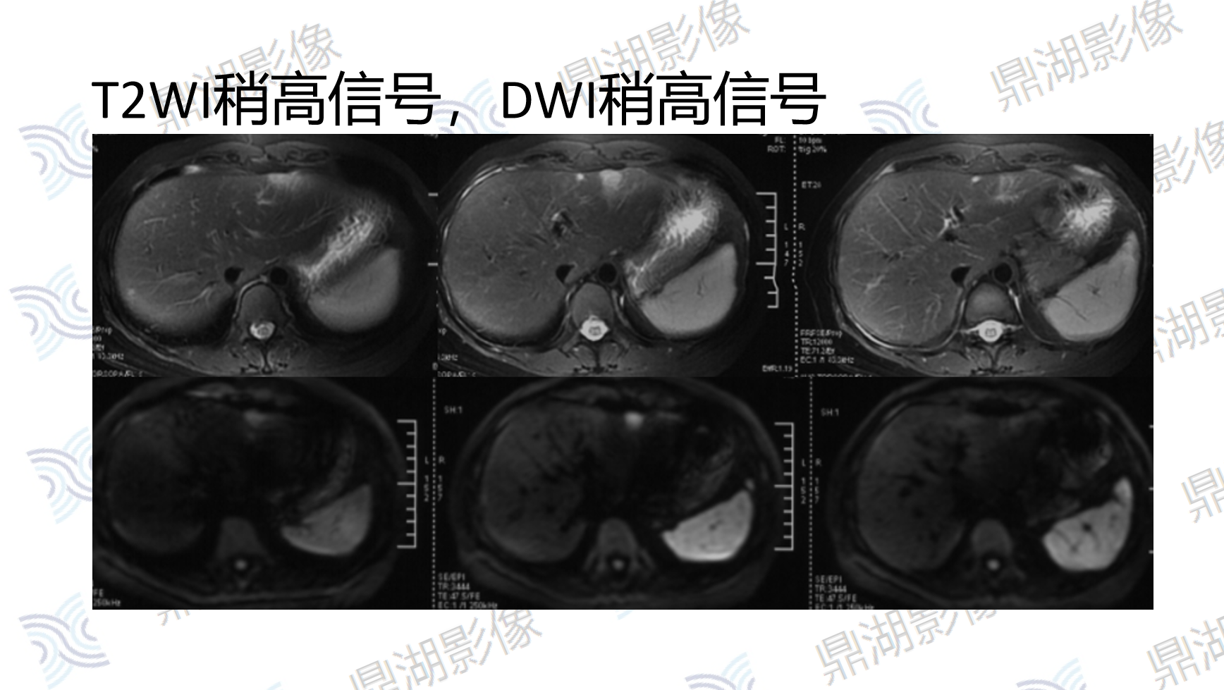 e919a7bde4980ee84b7563e52bbfa573.png