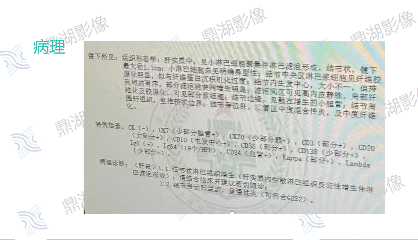 07b6a428aa5ff985a12556c97736206a.png