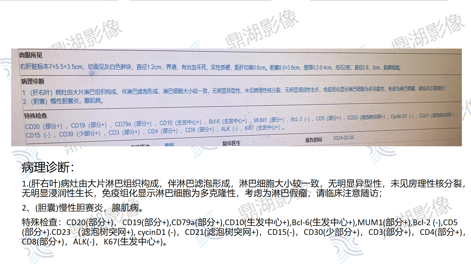 aaa39a9cfa15b04f2026f0c2c938786f.png
