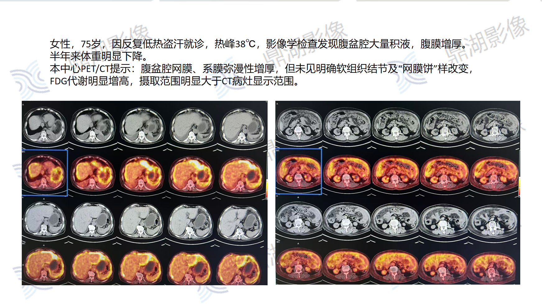 6a250152c73ee2826ea9bceb82dccdfa.png 6a250152c73ee2826ea9bceb82dccdfa.png