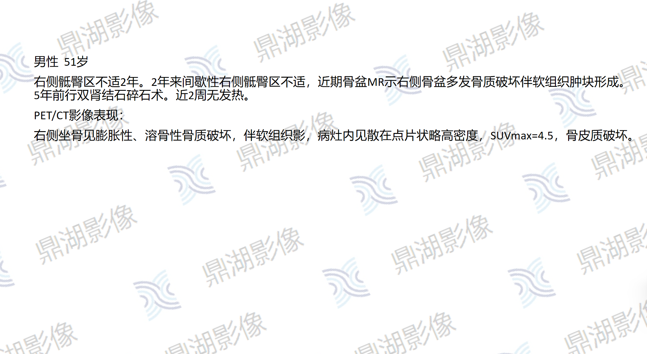 dd534c81d574ba5f3fc2cf5de082f373.png dd534c81d574ba5f3fc2cf5de082f373.png