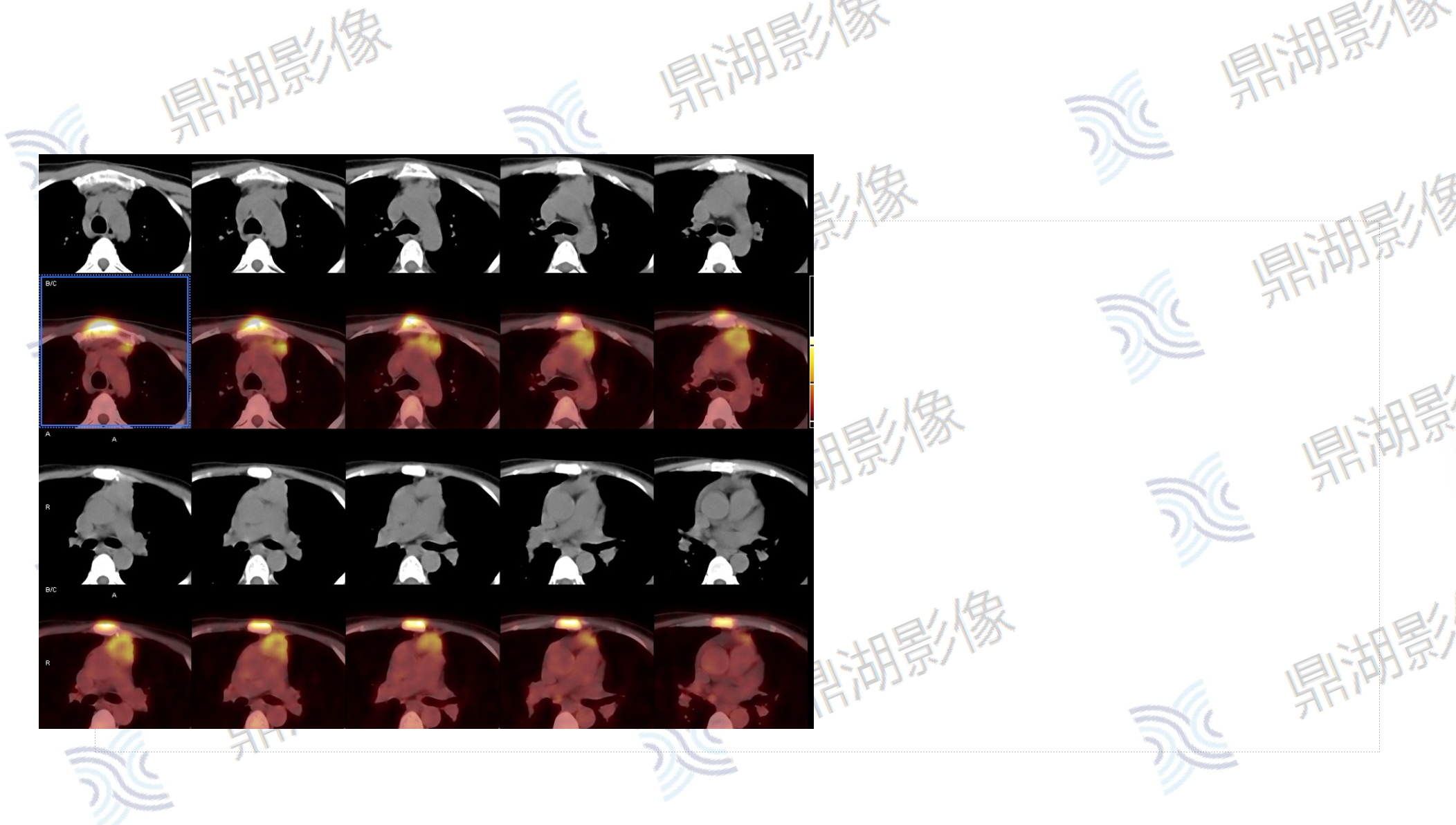 53908e6f7267bf4289ea1bca76254115.png 53908e6f7267bf4289ea1bca76254115.png