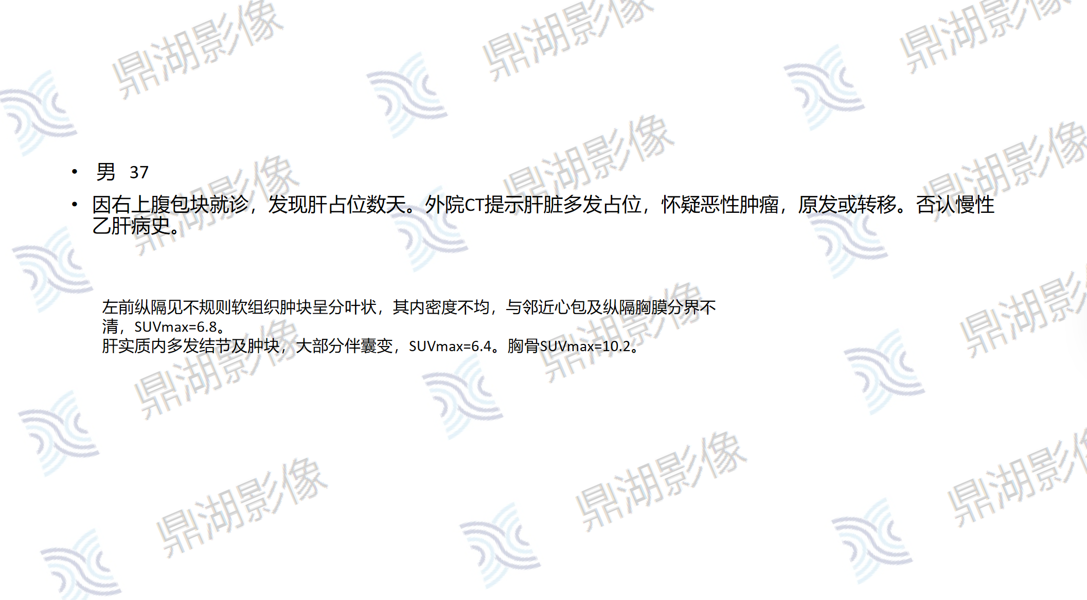 bed3b4398bc2525c2d5a6a9a0b1972b6.png bed3b4398bc2525c2d5a6a9a0b1972b6.png