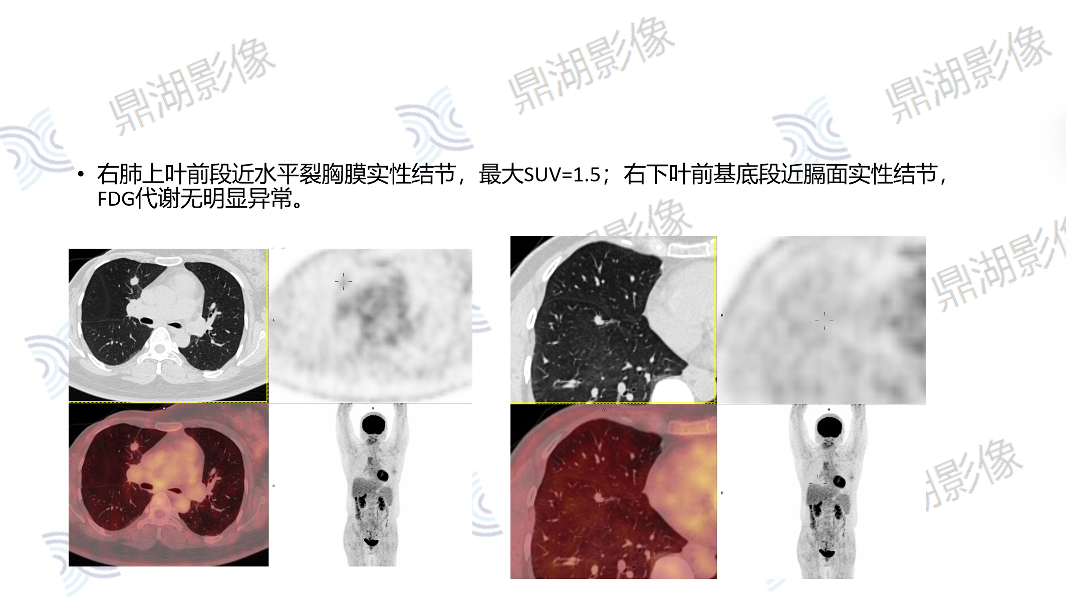 007f81a2562113bb9a30936cc49a0faf.png 007f81a2562113bb9a30936cc49a0faf.png
