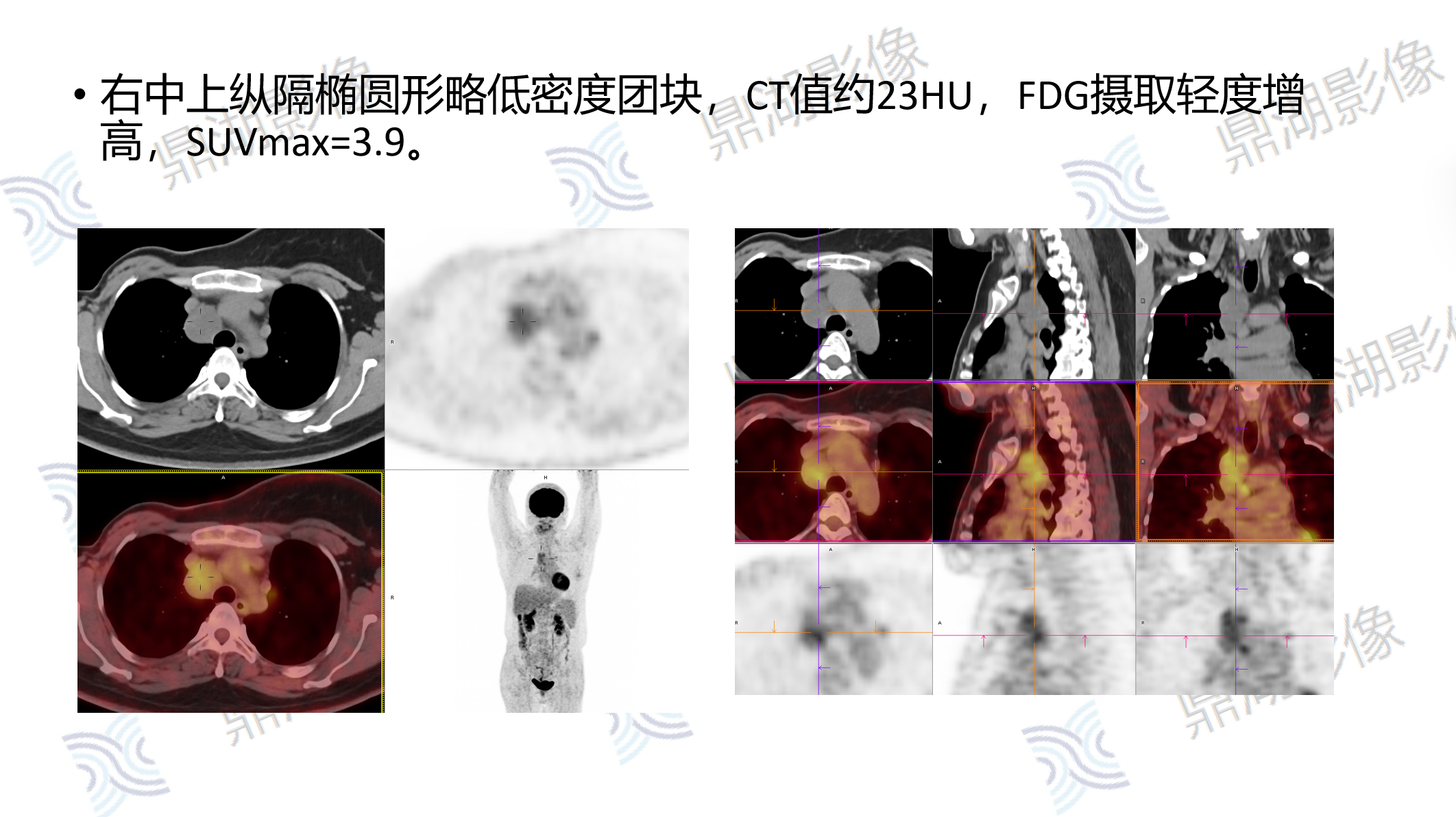 b4cbf926a3100e41ac902d9d50904769.png b4cbf926a3100e41ac902d9d50904769.png