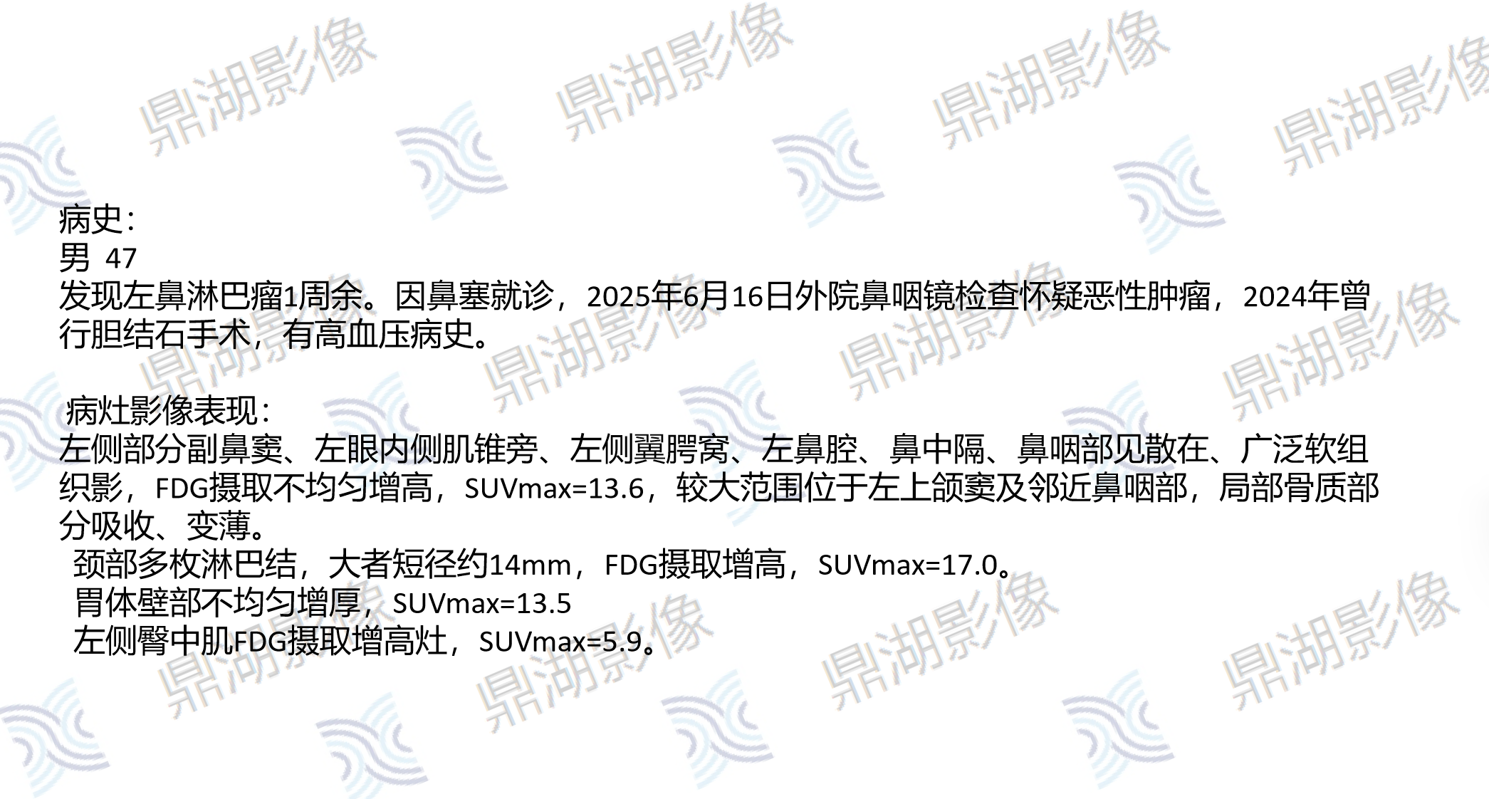 100014c0be0ce543e6802627c57e848e.png 100014c0be0ce543e6802627c57e848e.png