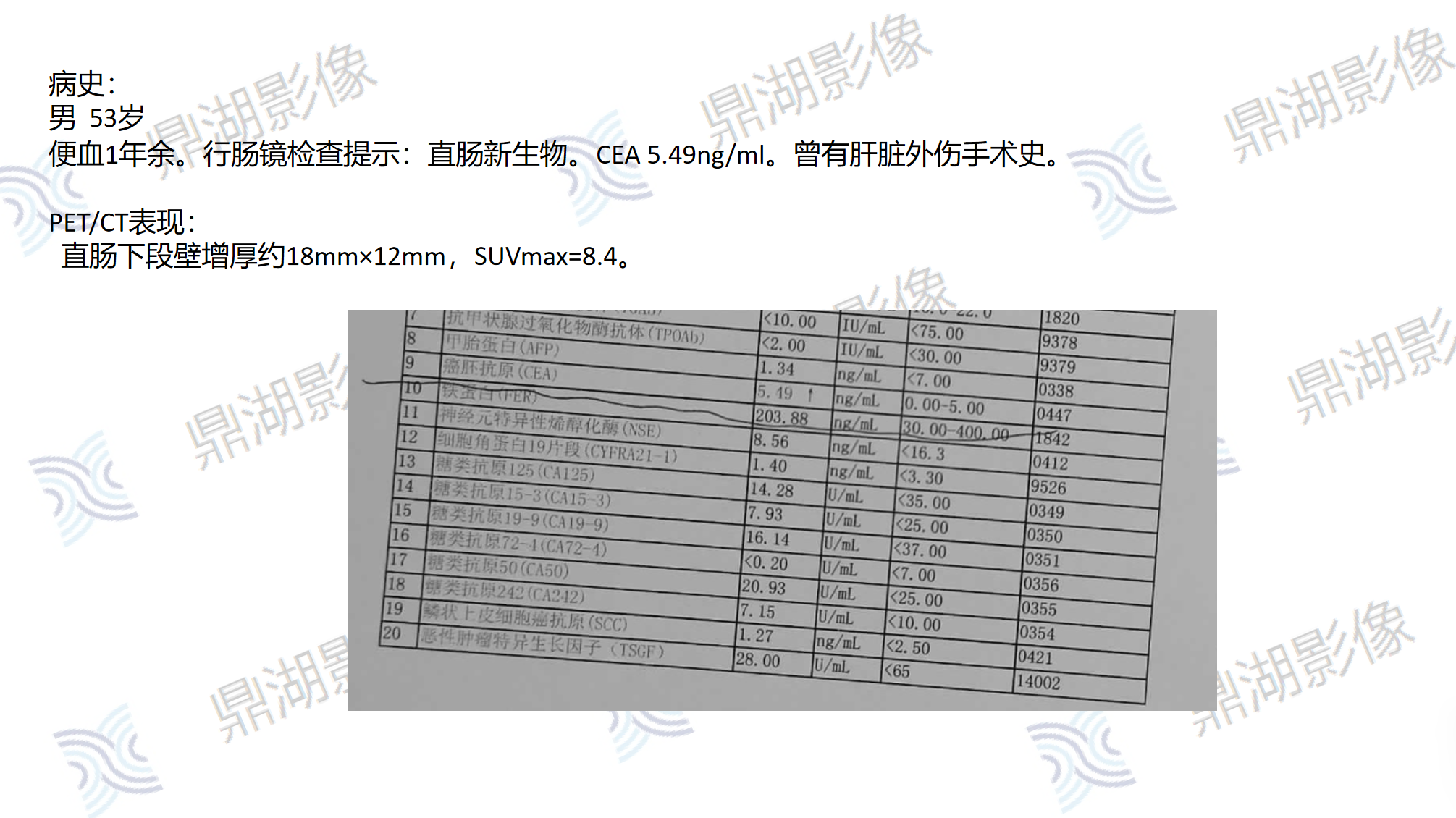 894975e855255ee9998dcefbd67b206f.png 894975e855255ee9998dcefbd67b206f.png