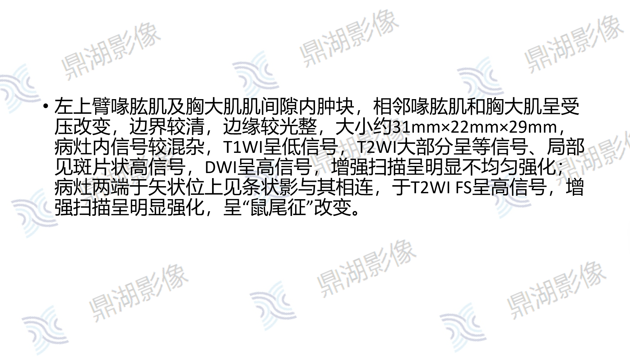 894af2756cd4ee82d8a89092c84e4757.png 894af2756cd4ee82d8a89092c84e4757.png