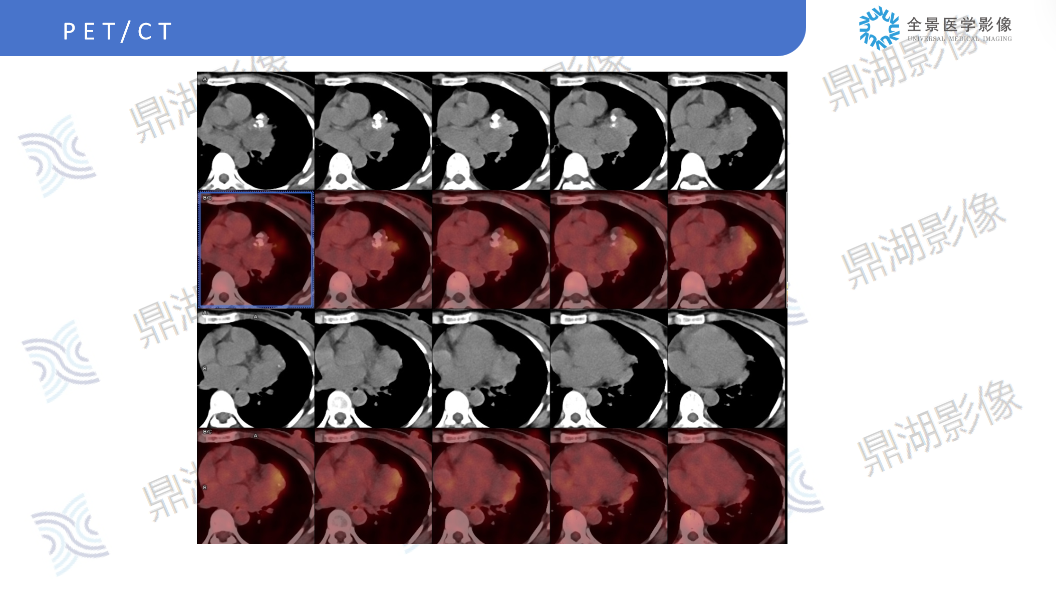e341730faad571b4ddc189a1cc1ce1ff.png