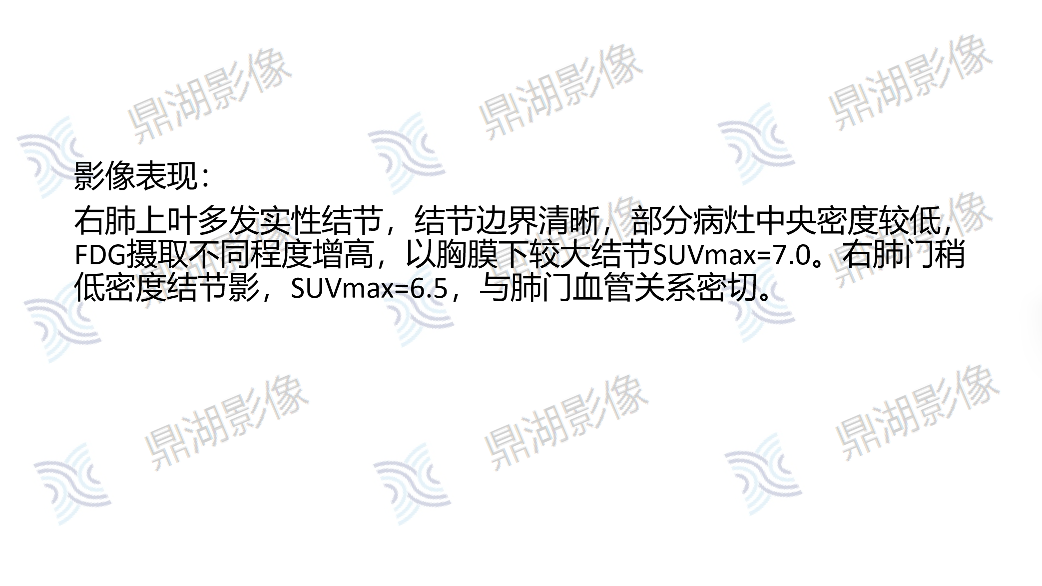 9922d7dd288f2a200a907fbfc04a8839.png 9922d7dd288f2a200a907fbfc04a8839.png