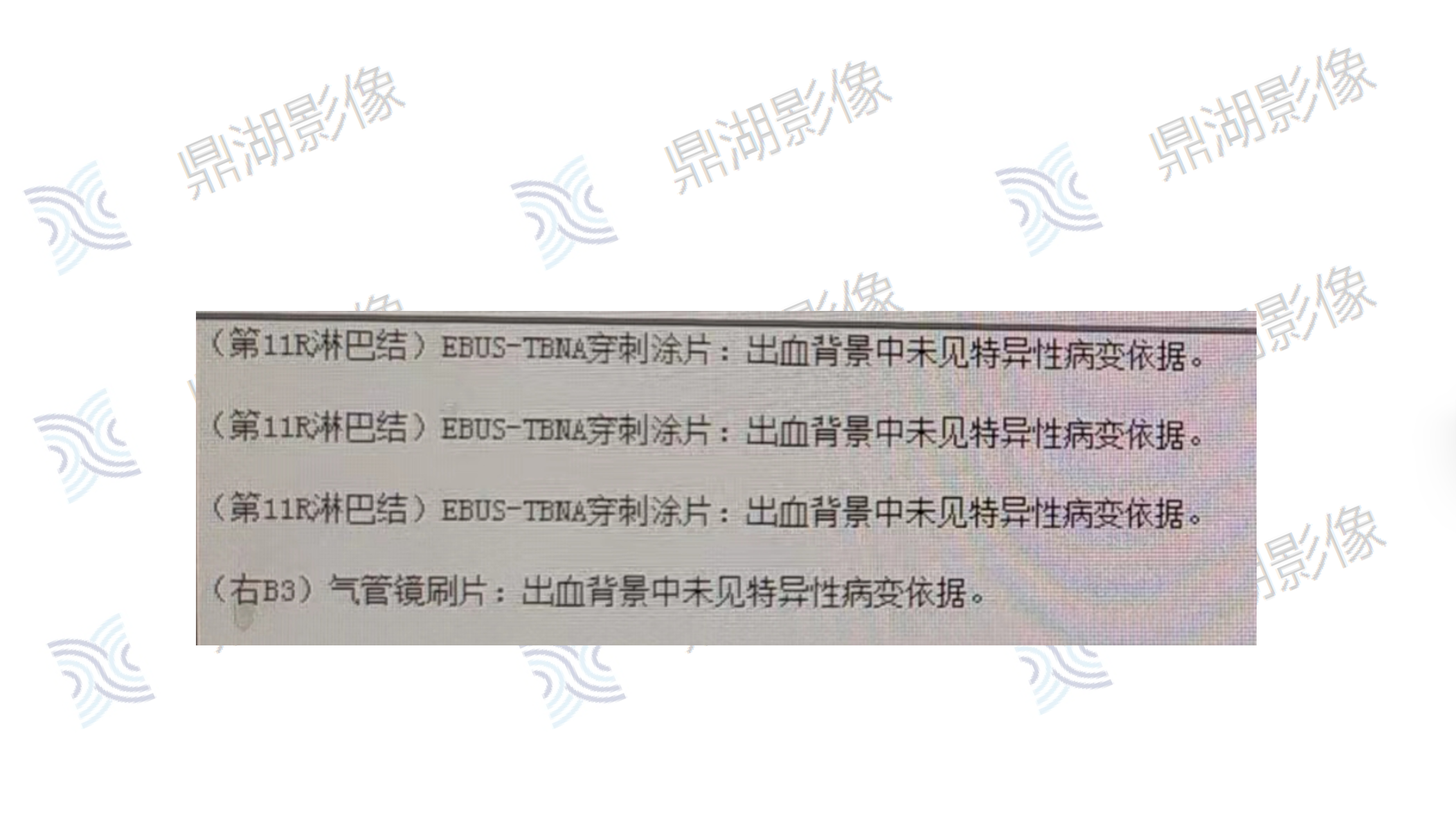 d291b042d03c2a5bf0262765d42cbcb2.png d291b042d03c2a5bf0262765d42cbcb2.png