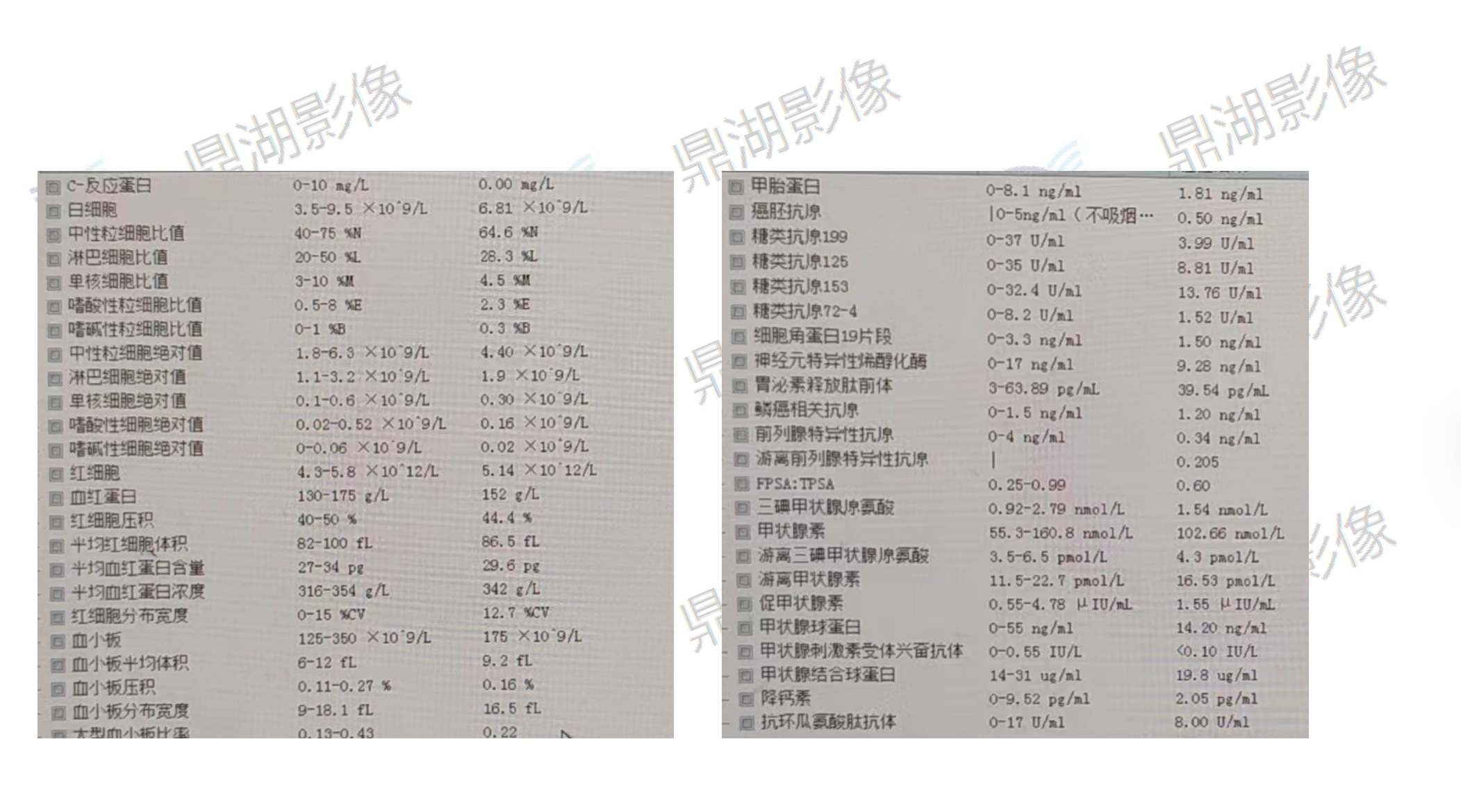 eaf4cd8835cc8ca1b4ba8420570783de.png eaf4cd8835cc8ca1b4ba8420570783de.png
