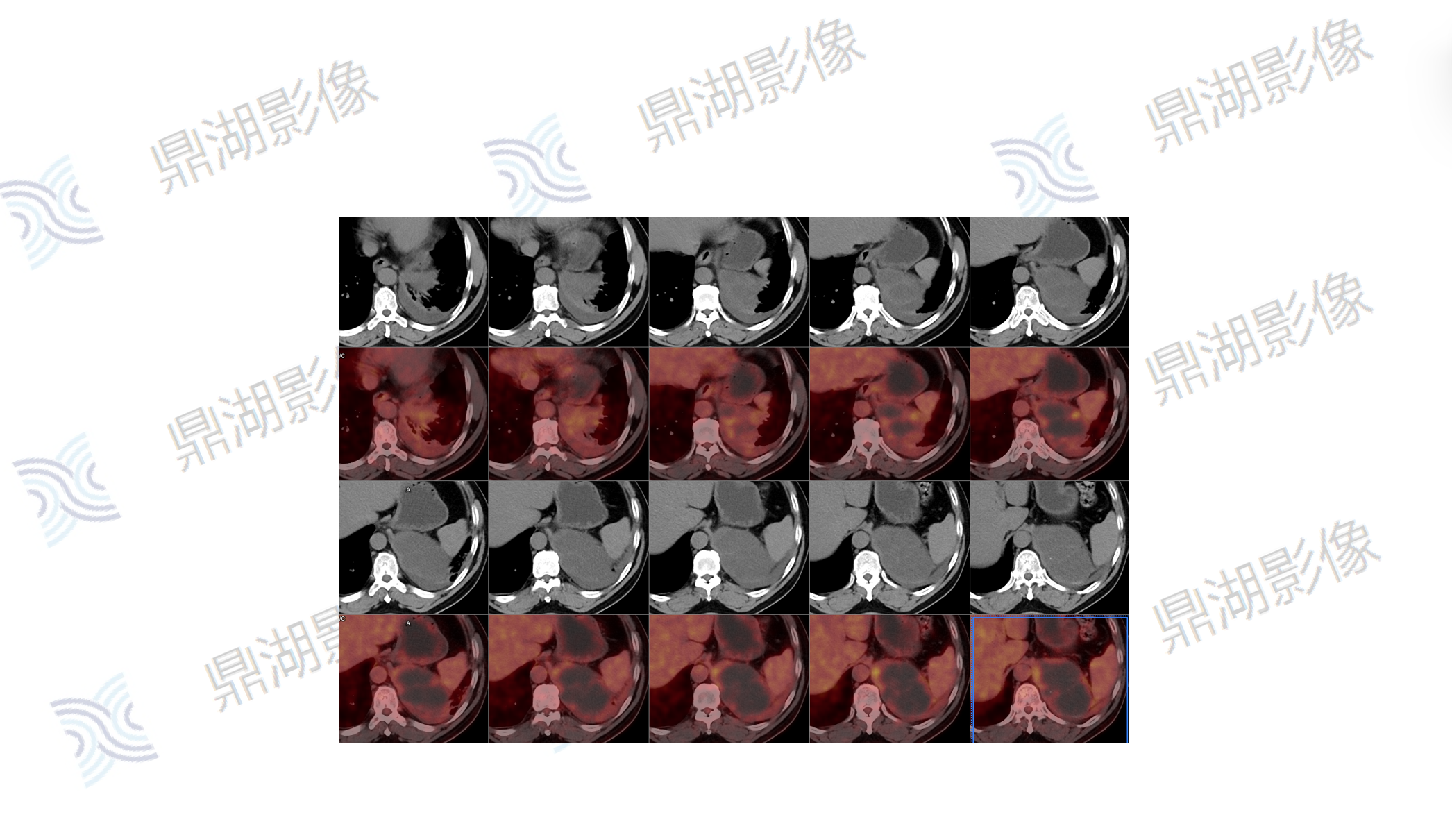 3f69bda1fec878f05755011ce1a85eab.png 3f69bda1fec878f05755011ce1a85eab.png