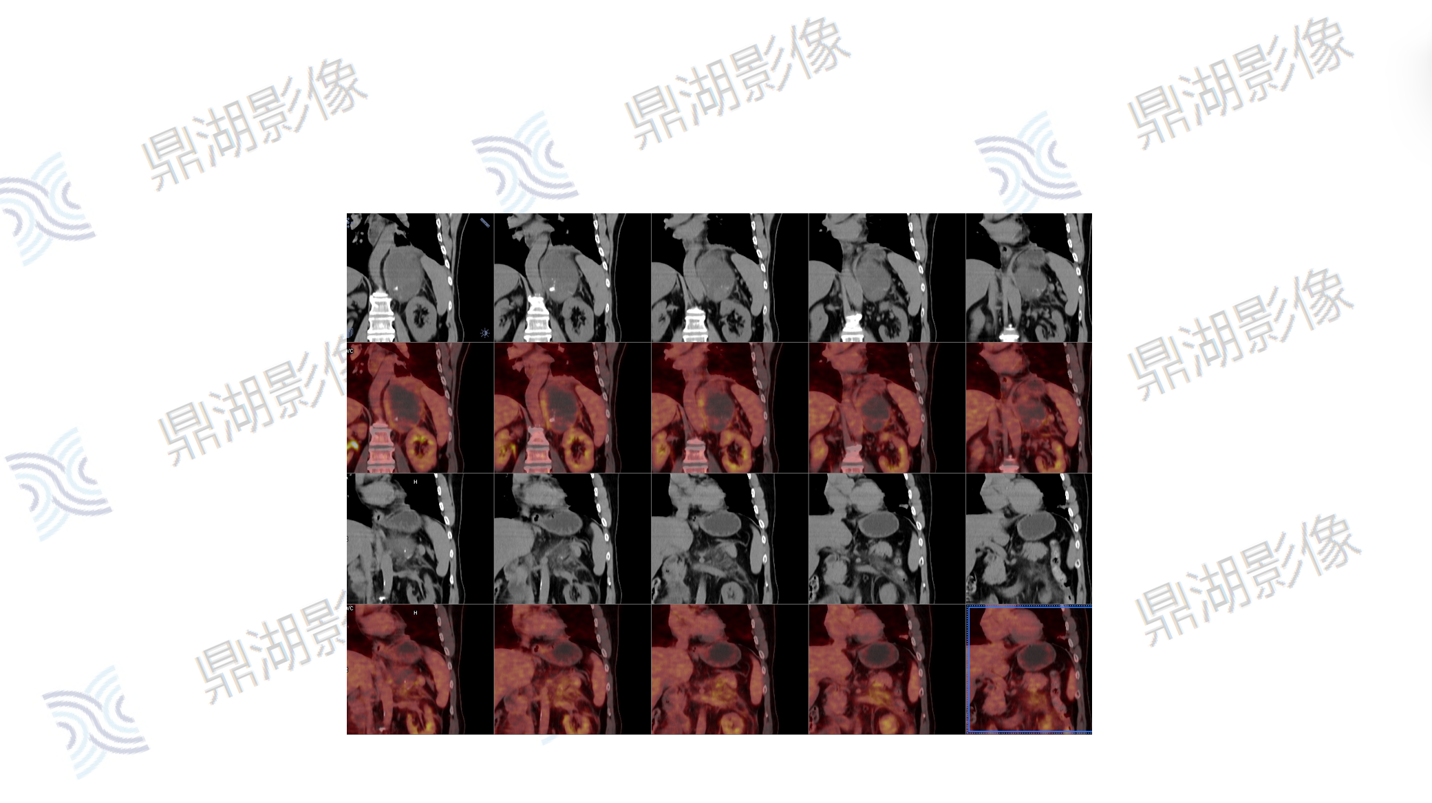 62f854122bad995b52bf5242b2b6d0d5.png 62f854122bad995b52bf5242b2b6d0d5.png