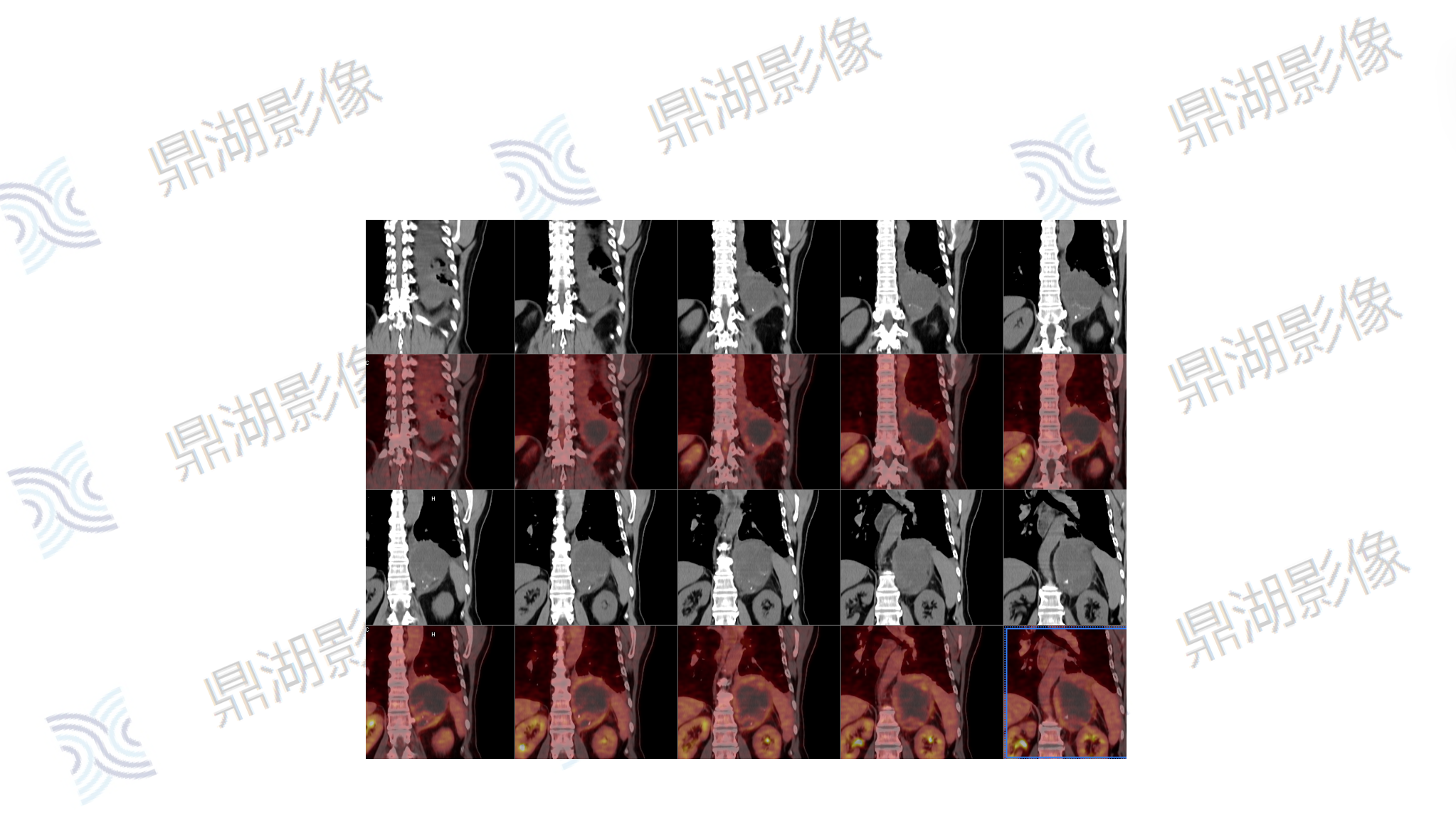 c6a68a44faac163b5dd0e06c6d49741b.png c6a68a44faac163b5dd0e06c6d49741b.png