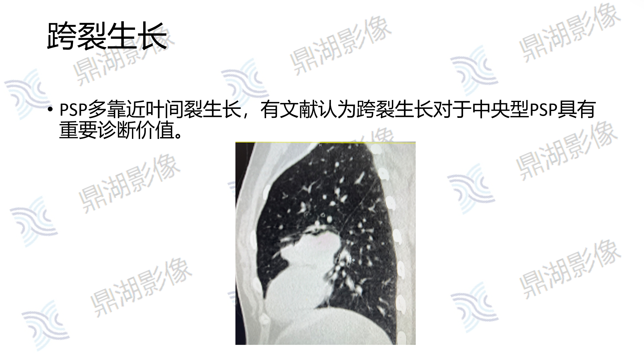 01cf753994a5acf958f9af82b64d8f11.png
